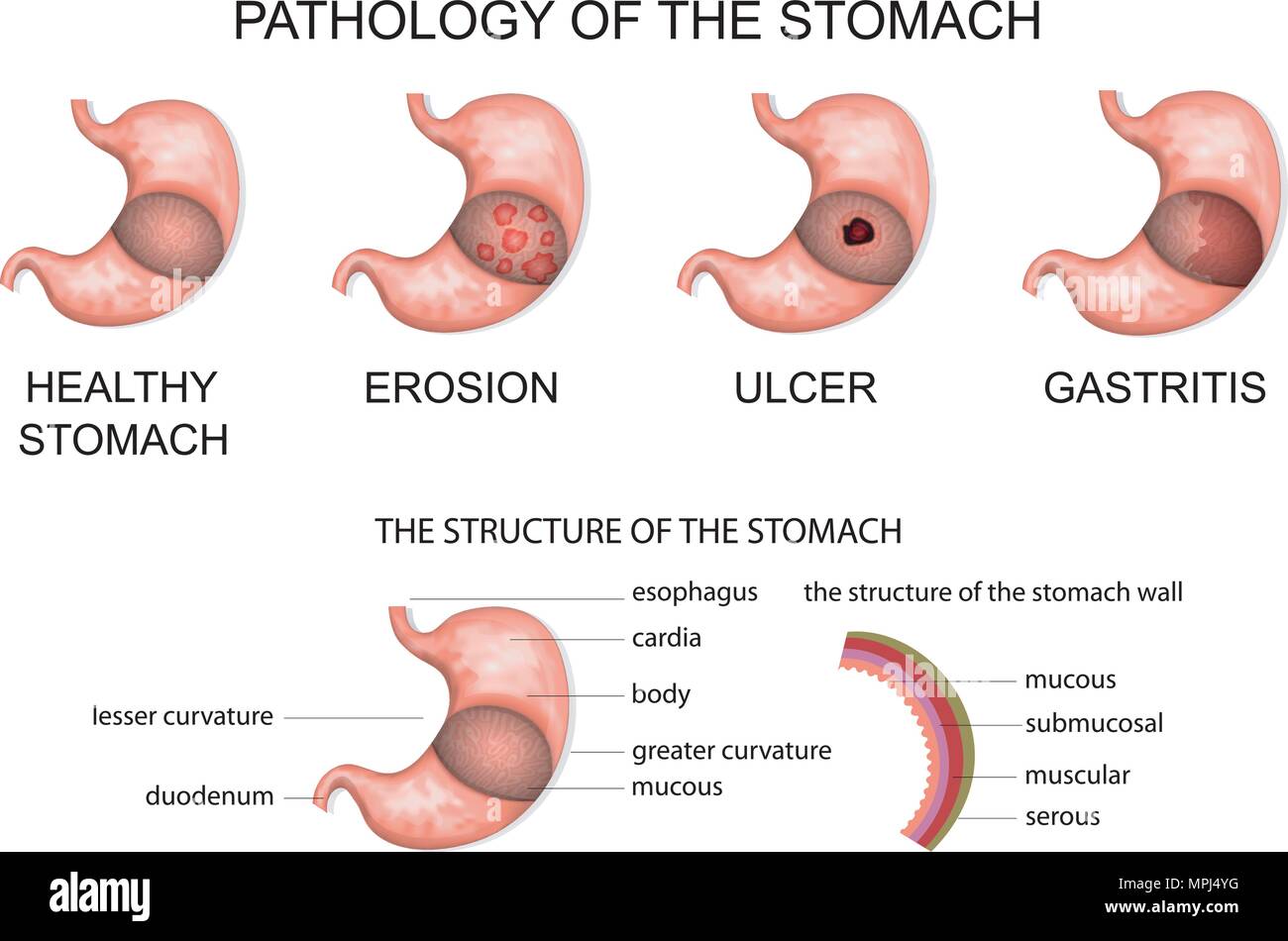 Patologia dello stomaco. anatomia dello stomaco Illustrazione Vettoriale