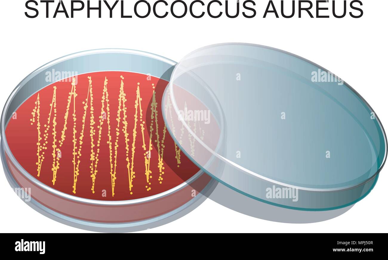 Illustrazione di una cultura di Staphylococcus aureus in una capsula di Petri Illustrazione Vettoriale