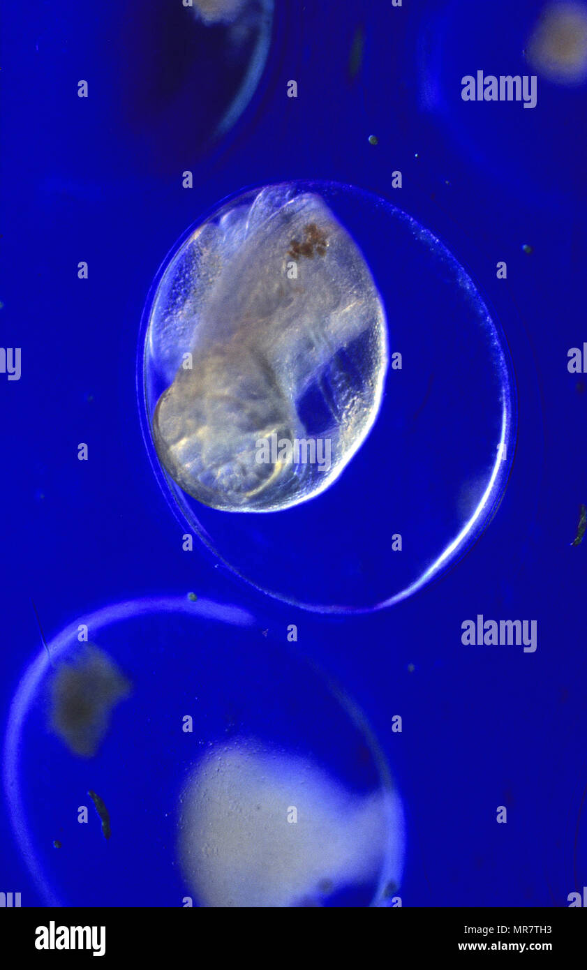 Uova di lumaca.Physella sp.Gastropodos.Mollusca.di microscopia ottica Foto Stock