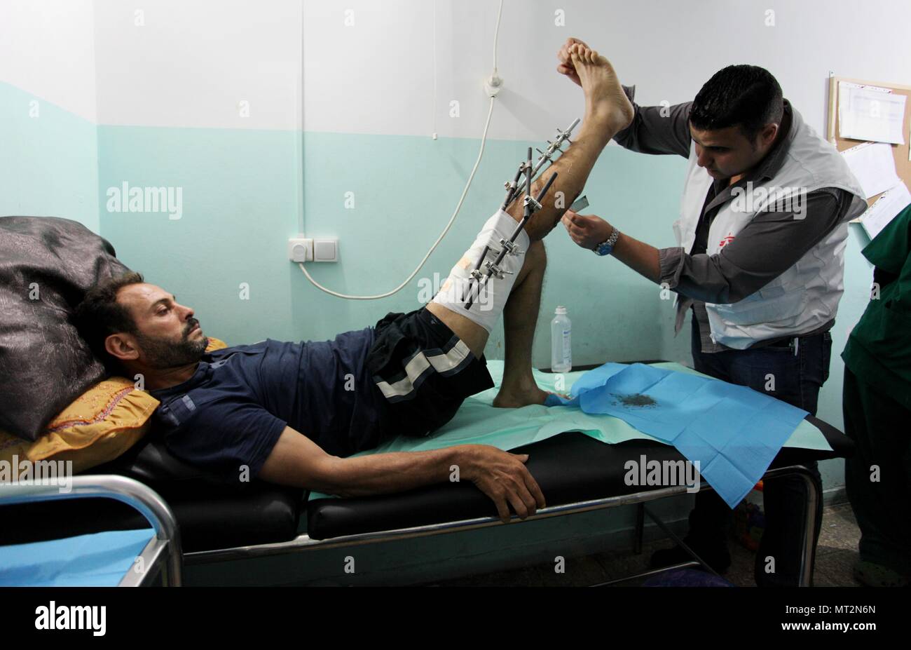 La città di Gaza, Striscia di Gaza, Territori palestinesi. 28 Maggio, 2018. Un ferito palestinese che era stato ferito durante gli scontri con le truppe israeliane in tende protesta dove palestinesi rivendicare i propri diritti per tornare in patria al confine Israel-Gaza, riceve il trattamento a Medici senza frontiere " SF'' clinica di Gaza City il 28 maggio 2018 Credit: Mahmoud Ajour/immagini APA/ZUMA filo/Alamy Live News Foto Stock