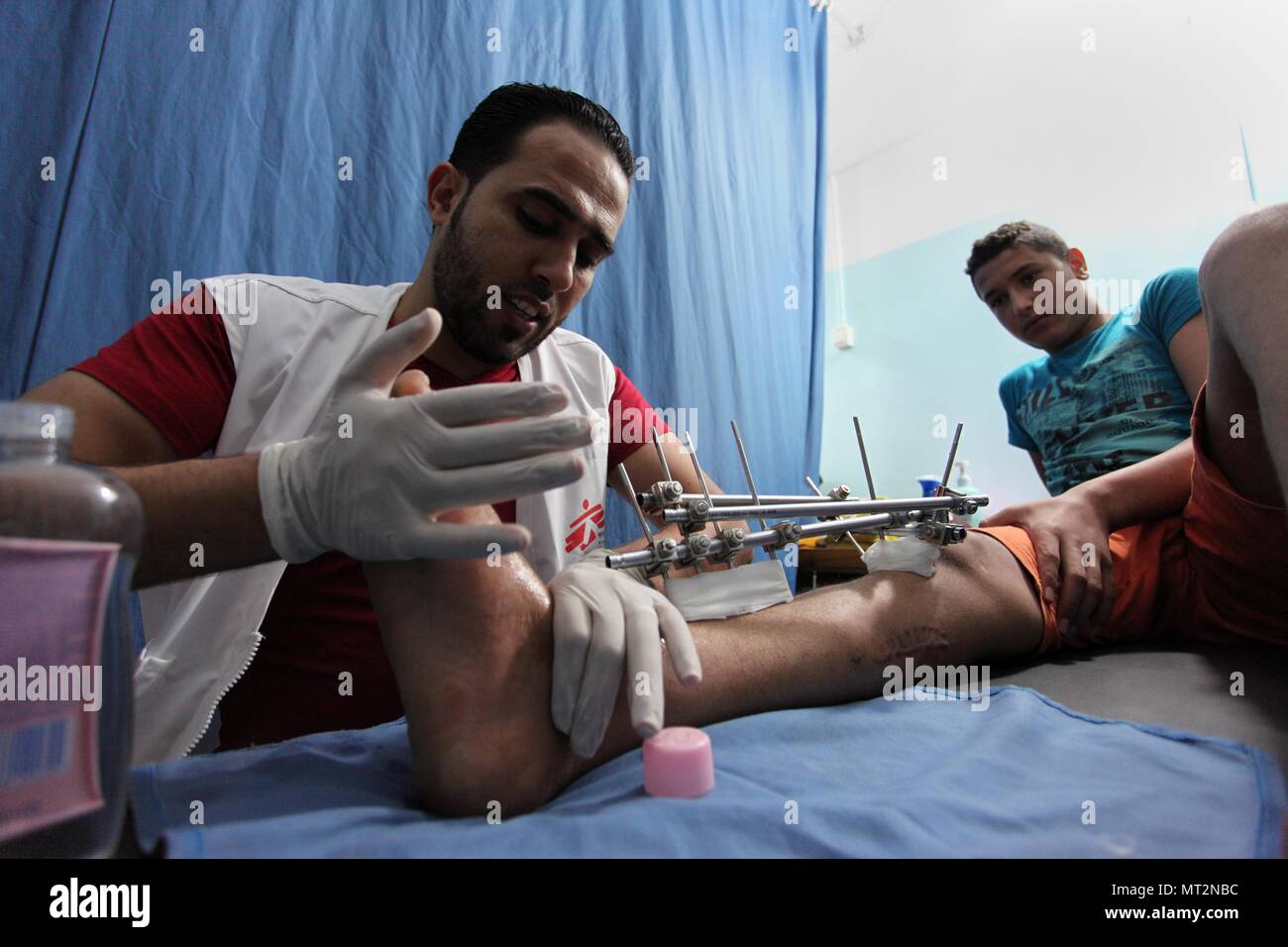 La città di Gaza, Striscia di Gaza, Territori palestinesi. 28 Maggio, 2018. Un ferito palestinese che era stato ferito durante gli scontri con le truppe israeliane in tende protesta dove palestinesi rivendicare i propri diritti per tornare in patria al confine Israel-Gaza, riceve il trattamento a Medici senza frontiere " SF'' clinica di Gaza City il 28 maggio 2018 Credit: Mahmoud Ajour/immagini APA/ZUMA filo/Alamy Live News Foto Stock