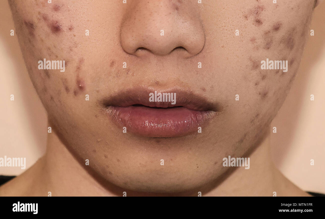 infiammazione della pelle del viso