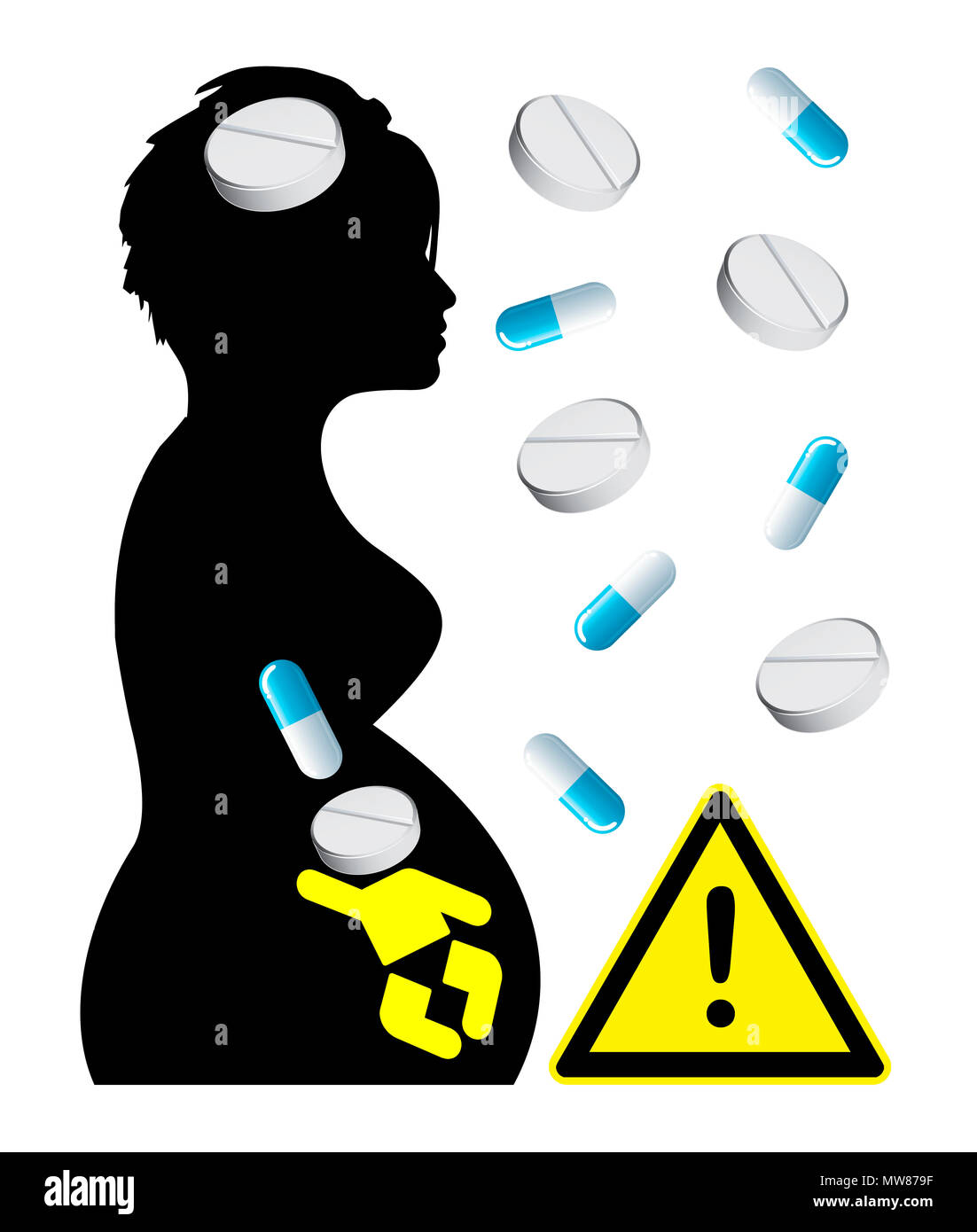 Effetti negativi dei farmaci presi durante la gravidanza sullo sviluppo globale del nascituro Foto Stock