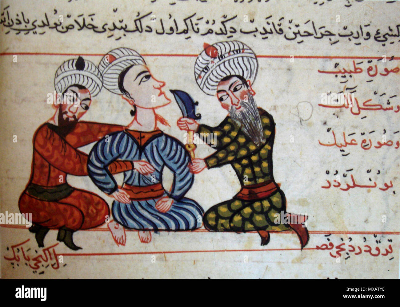 127 ChirurgicalOperation15thCentury Foto Stock