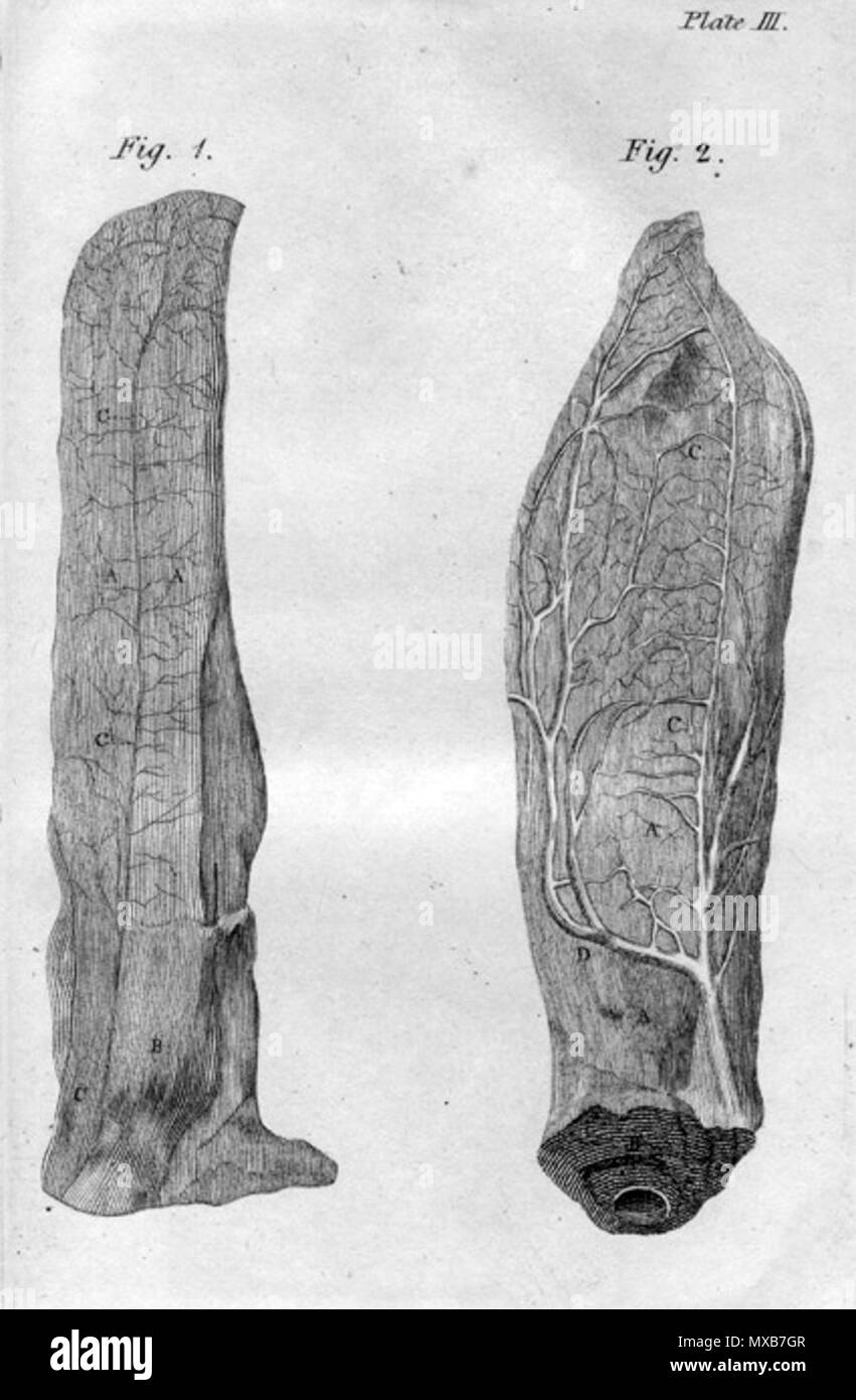 . Inglese: John Hunter (1728-1793): un trattato sul sangue, infiammazione e Gun-shot ferite, 1796. "Due conigli' orecchie, uno allo stato naturale, l'altra in un stato infiammato, in conseguenza del fatto che sono state congelate e scongelate." . Gennaio 2008. McLeod 288 Hunter orecchie di coniglio Foto Stock