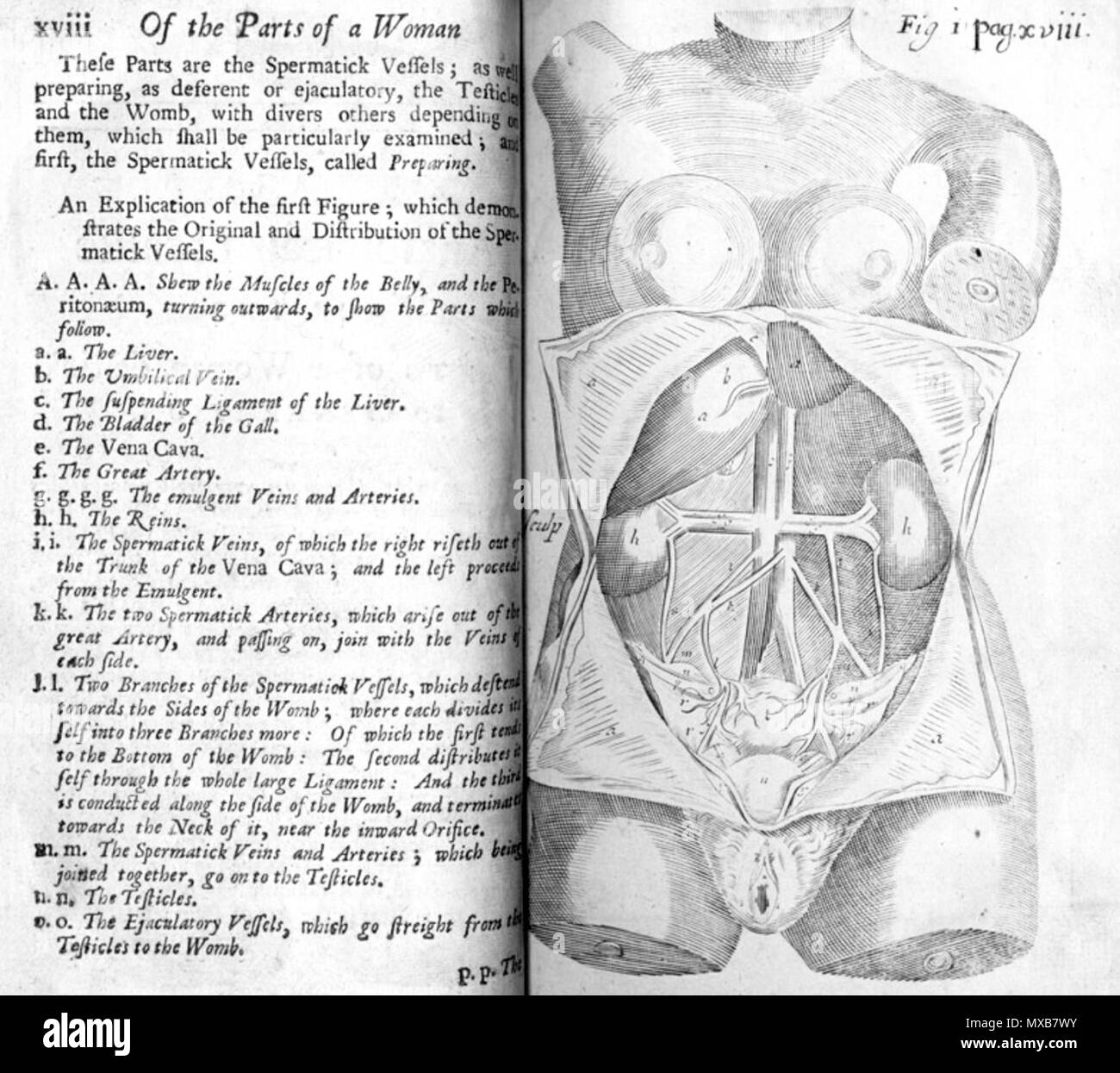 . François Mauriceau (1637-1709): le malattie delle donne con bambino e nel letto bambino, 1716. Gennaio 2008. McLeod 408 Mauriceau parti di una donna Foto Stock