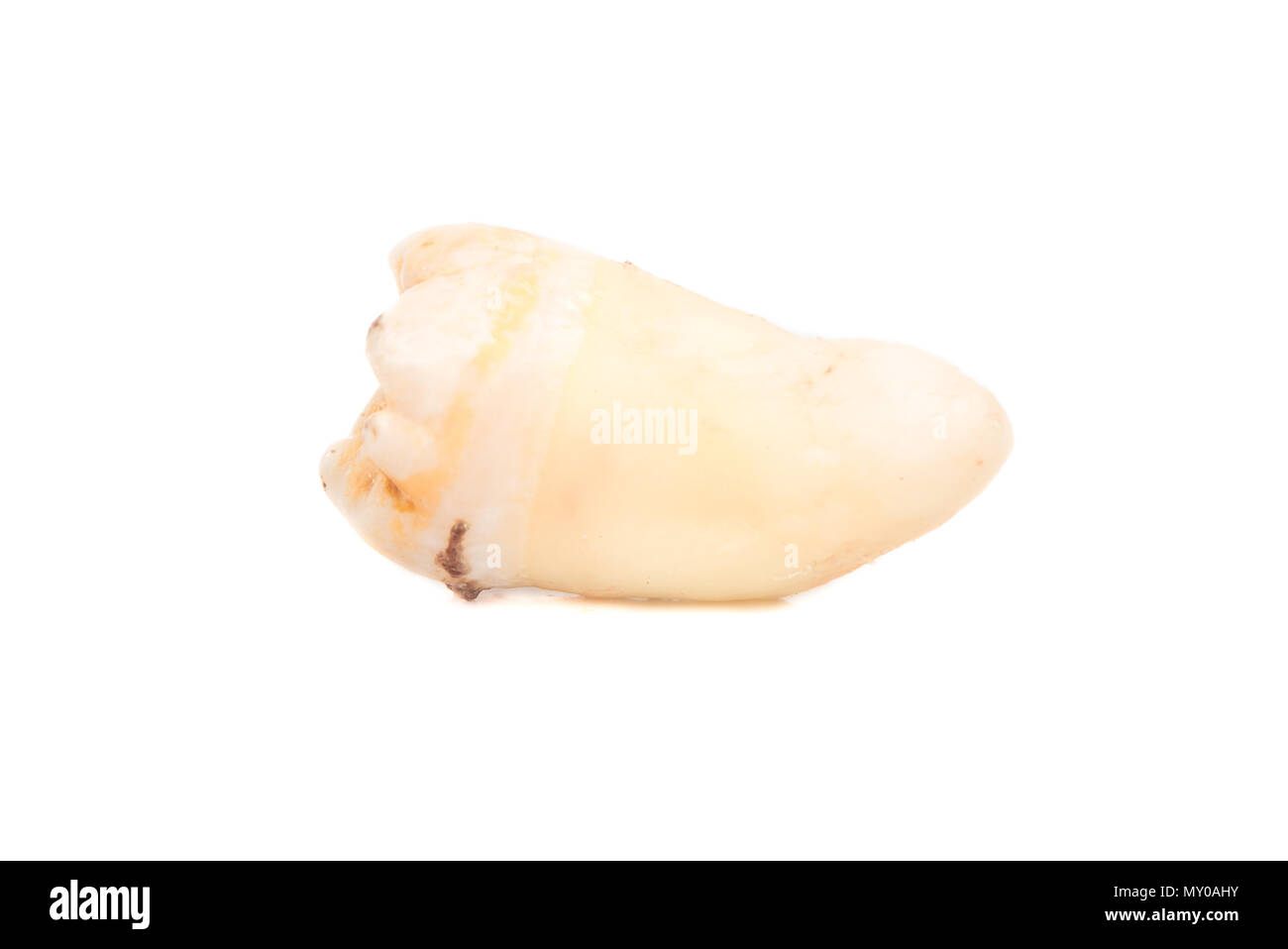 Il paziente è un dente umano isolato su sfondo bianco Foto Stock