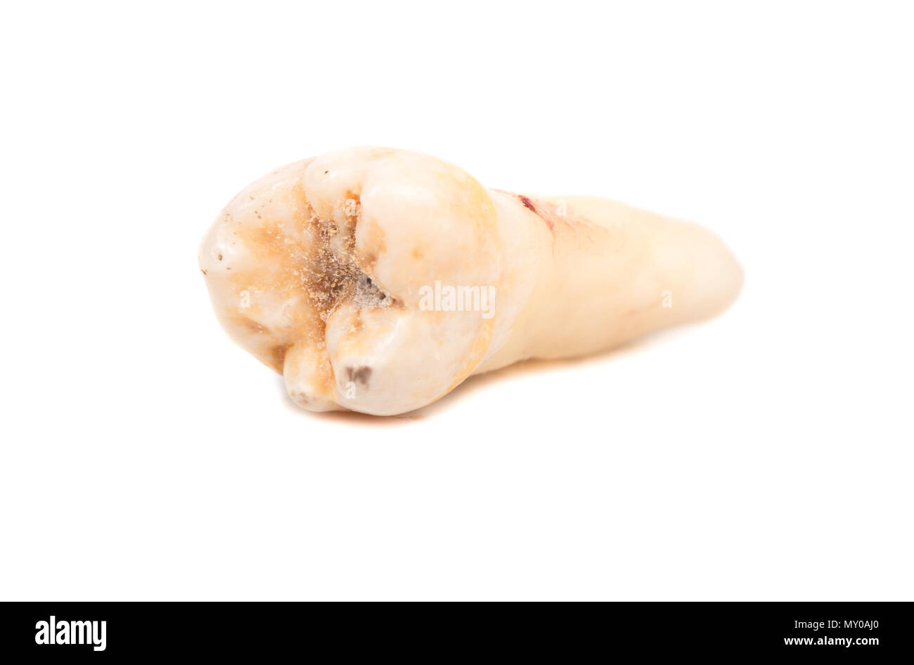 Il paziente è un dente umano isolato su sfondo bianco Foto Stock