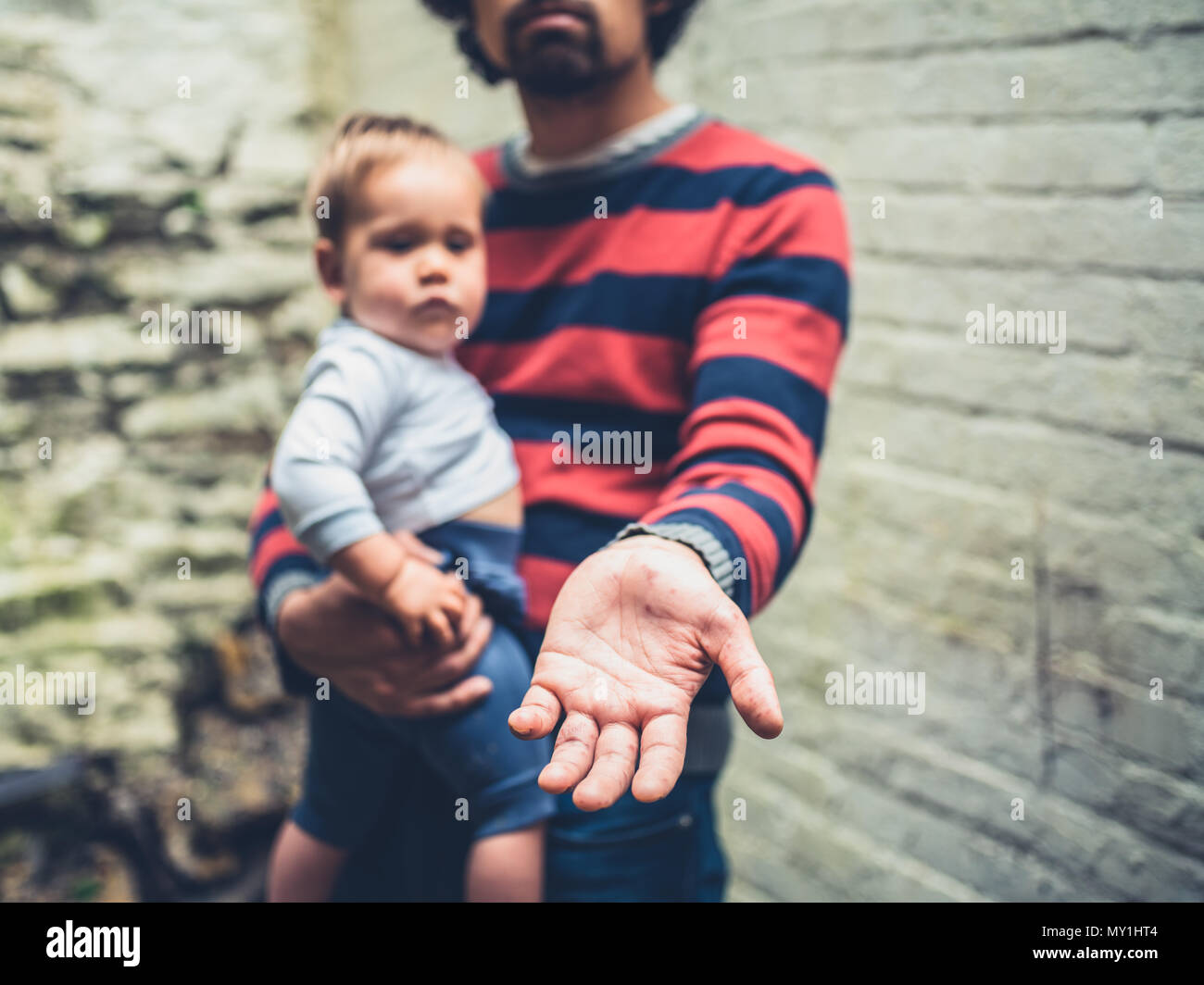Un giovane uomo con macchie sulle mani dalla malattia è a mendicare con un bambino al di fuori Foto Stock