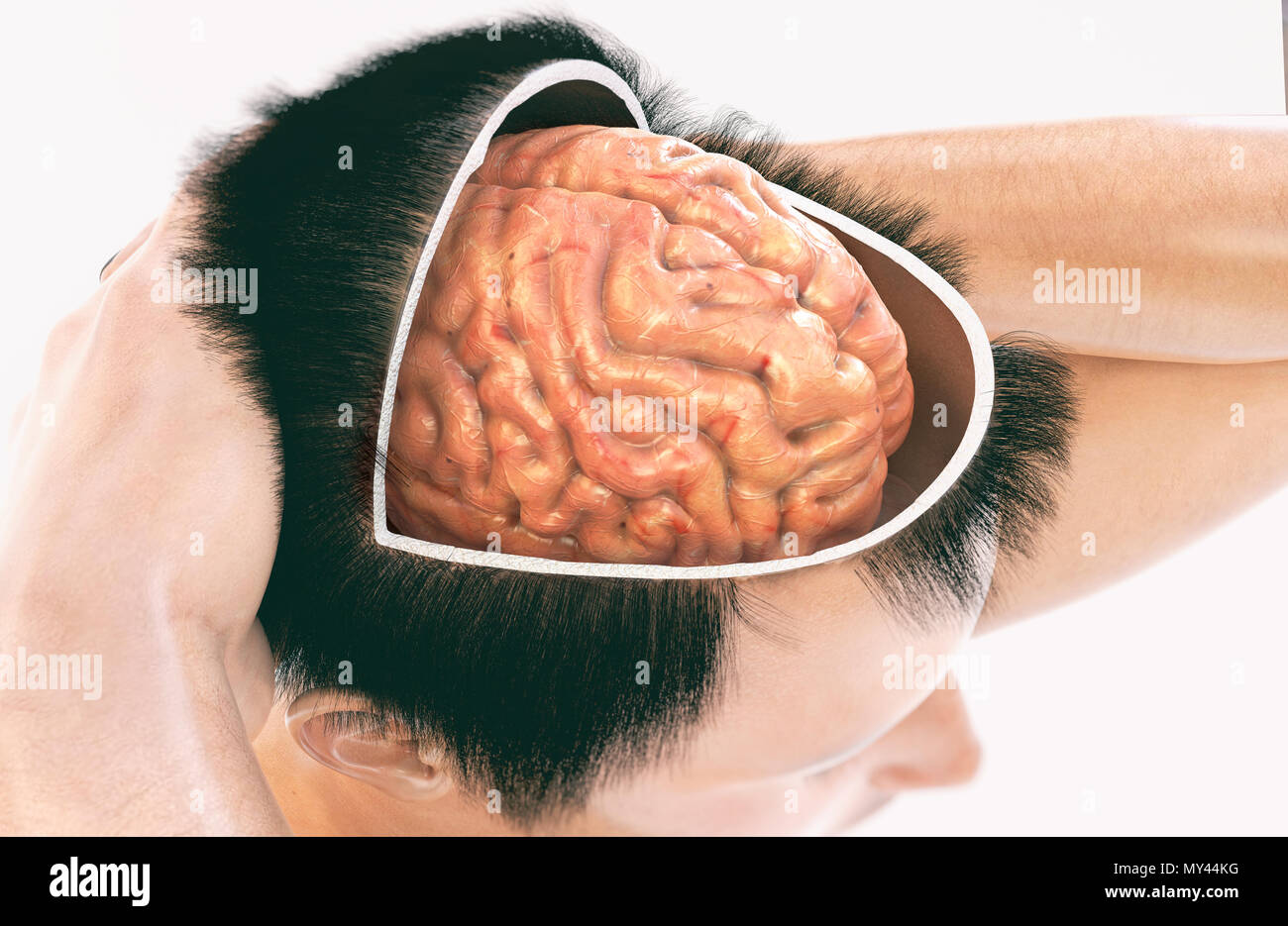 La demenza e la malattia di Alzheimer - immagine 1 di 2 - 3D Rendering Foto Stock