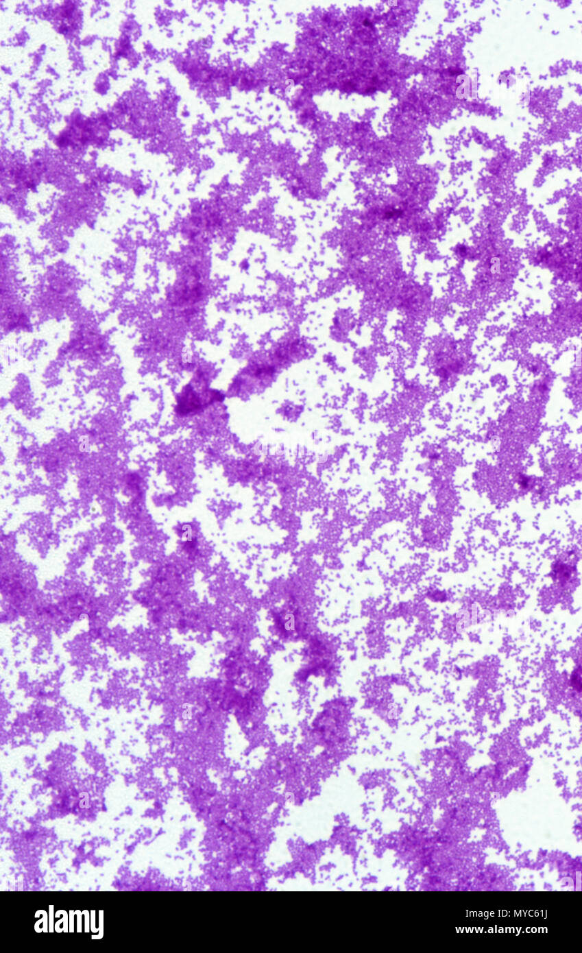 Haemophilus influenzae di batteri Foto Stock