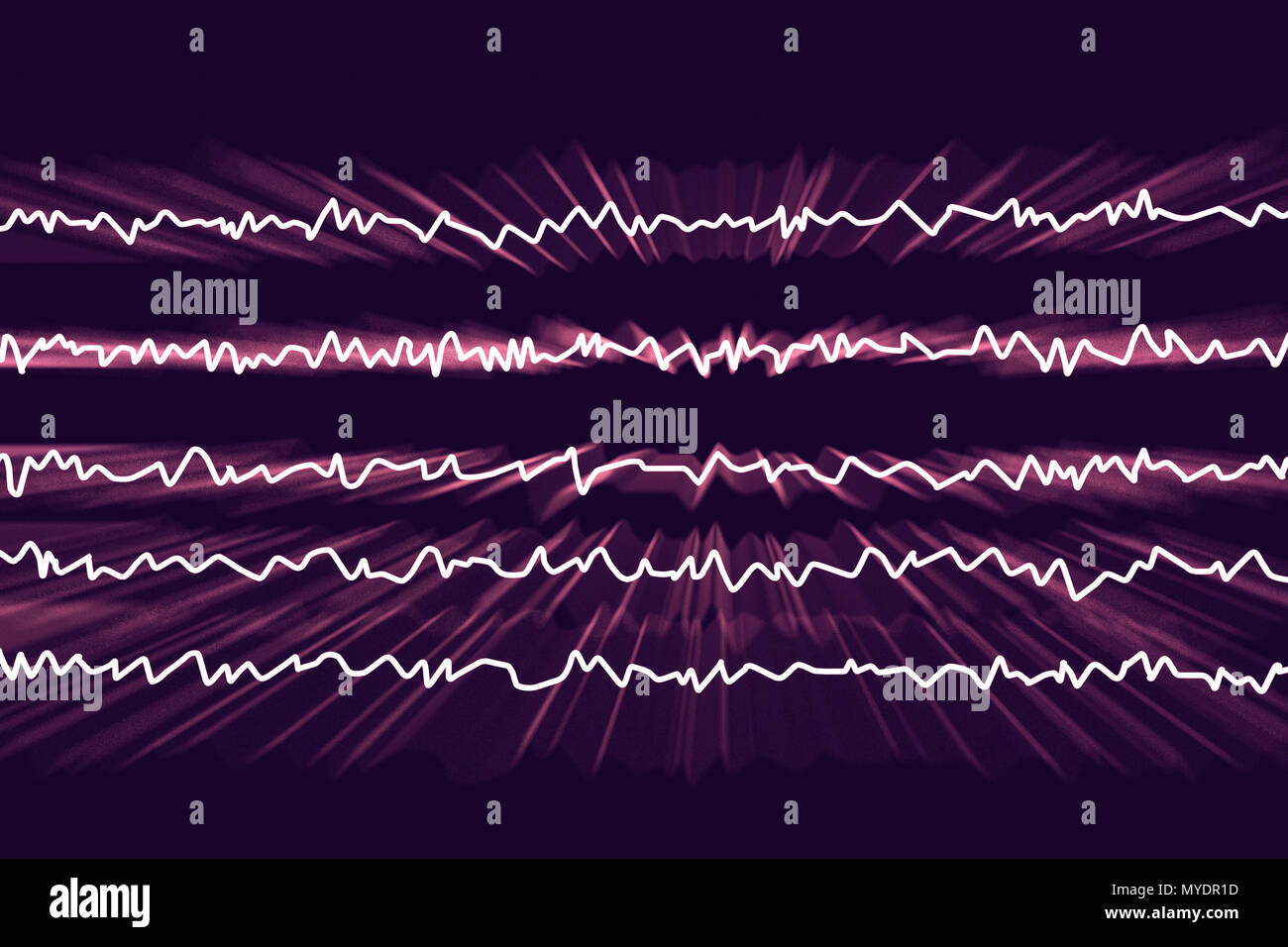 Le onde cerebrali in dello stato di veglia con attività mentale, illustrazione del computer. Un'elettroencefalogramma (EEG) misura l'attività elettrica del cervello utilizzando elettrodi collegati al cuoio capelluto. Vari disturbi possono essere diagnosticati analizzando i risultati EEG. Foto Stock