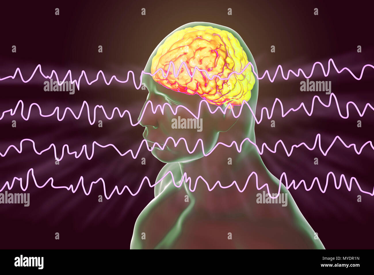 Il cervello e le onde cerebrali in stato sveglio durante il riposo, illustrazione del computer. Un'elettroencefalogramma (EEG) misura l'attività elettrica del cervello utilizzando elettrodi collegati al cuoio capelluto. Vari disturbi possono essere diagnosticati analizzando i risultati EEG. Foto Stock