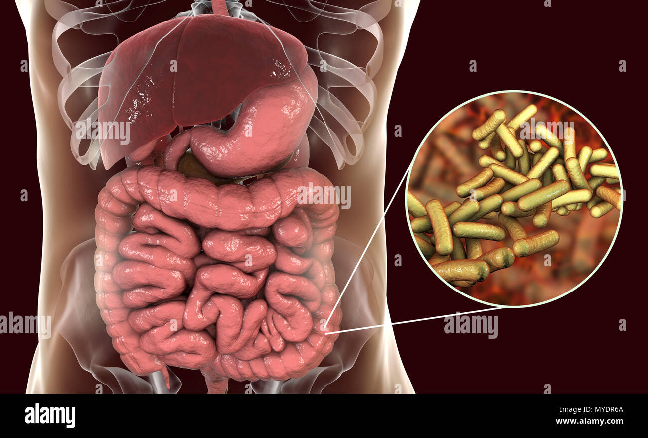 Schigellosi, una infezione causata da batteri Shigella, illustrazione del  computer. Shigella sp. sono Gram-negativi a forma di asta (batteri  bacilli). Essi infettano il grande intestino e causare dissenteria, che  possono variare in