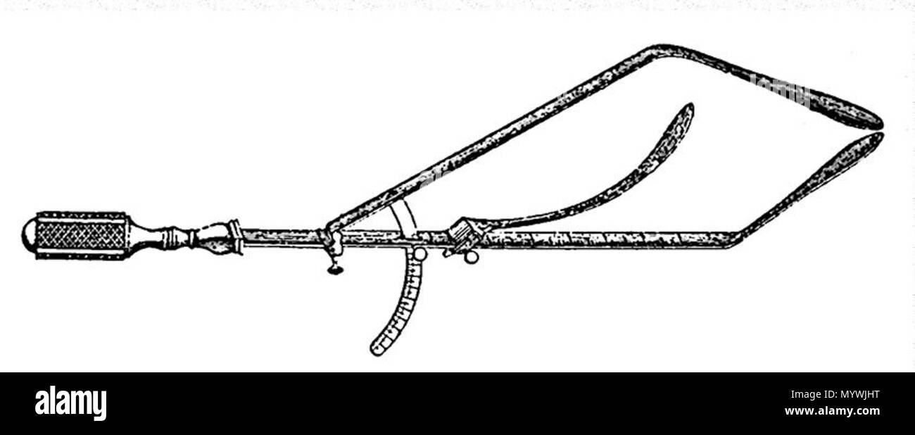 51 Intro-pelvimètre de Madame Boivin Foto Stock