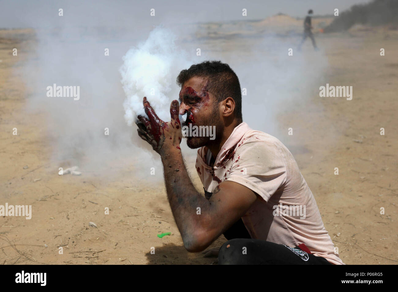 Khan Younis, Striscia di Gaza, Territori palestinesi. 8 Giugno, 2018. Un ferito manifestante palestinese reagisce come egli è colpito in pieno volto con uno strappo bombola del gas sparati dalle truppe israeliane durante una manifestazione di protesta per la marcatura di Al Quds-Day (Giorno di Gerusalemme), al confine Israel-Gaza in Khan Younis nel sud della striscia di Gaza su Giugno 8, 2018 Credit: Ashraf Amra/immagini APA/ZUMA filo/Alamy Live News Foto Stock