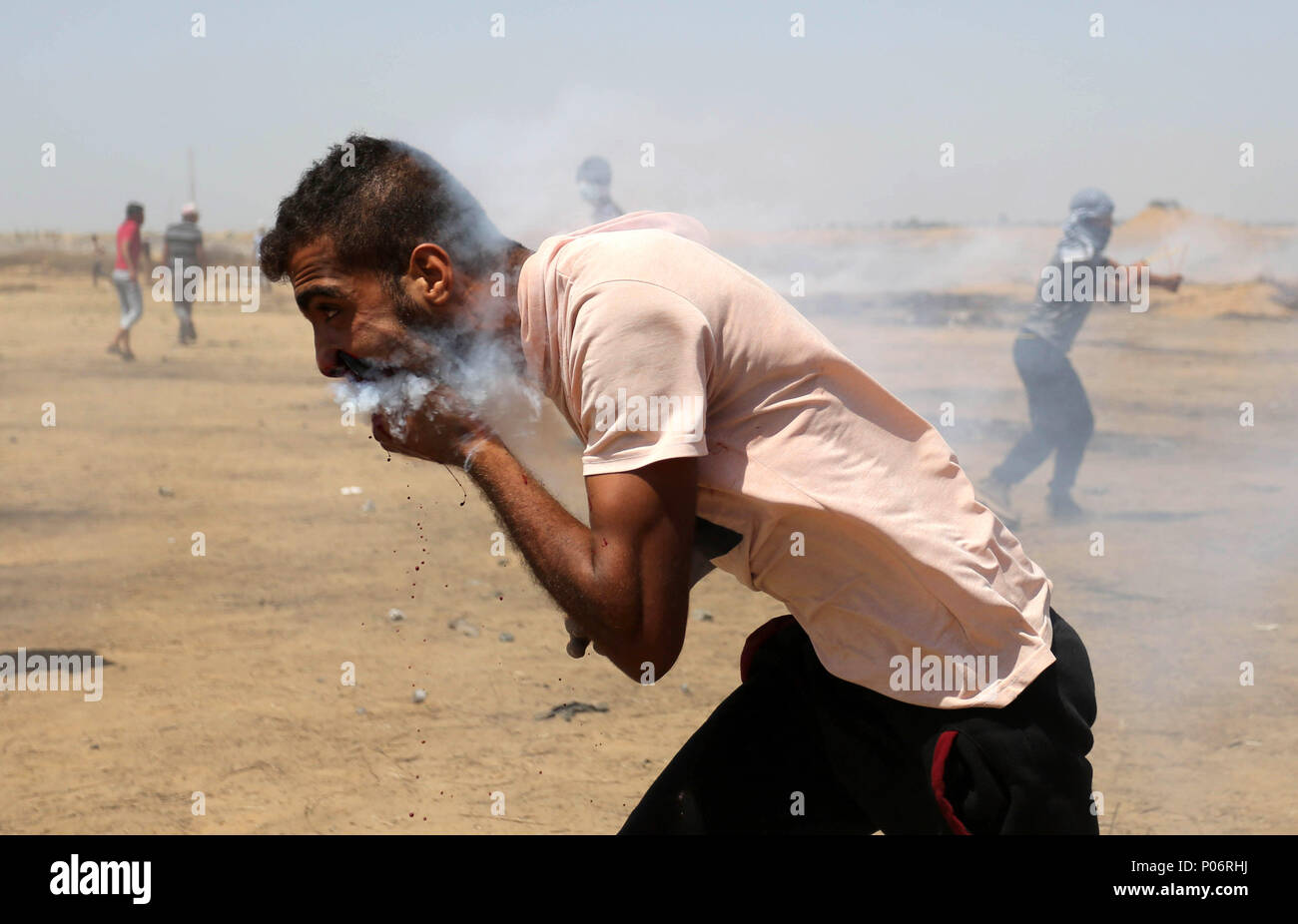 Khan Younis, Striscia di Gaza, Territori palestinesi. 8 Giugno, 2018. Un ferito manifestante palestinese reagisce come egli è colpito in pieno volto con uno strappo bombola del gas sparati dalle truppe israeliane durante una manifestazione di protesta per la marcatura di Al Quds-Day (Giorno di Gerusalemme), al confine Israel-Gaza in Khan Younis nel sud della striscia di Gaza su Giugno 8, 2018 Credit: Ashraf Amra/immagini APA/ZUMA filo/Alamy Live News Foto Stock