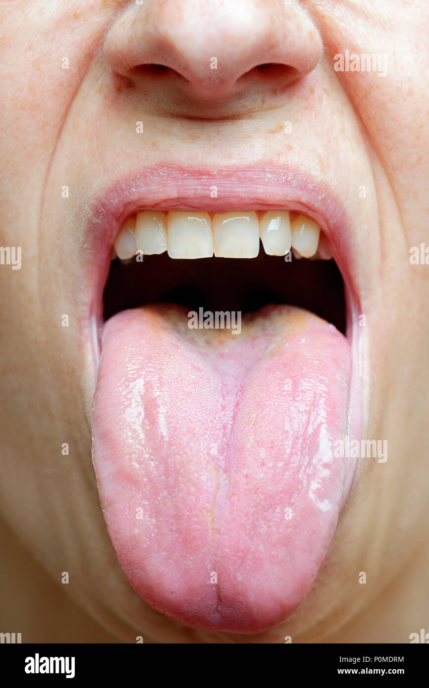 Grippaggio della donna la sua lingua fuori, vicino fino Foto Stock