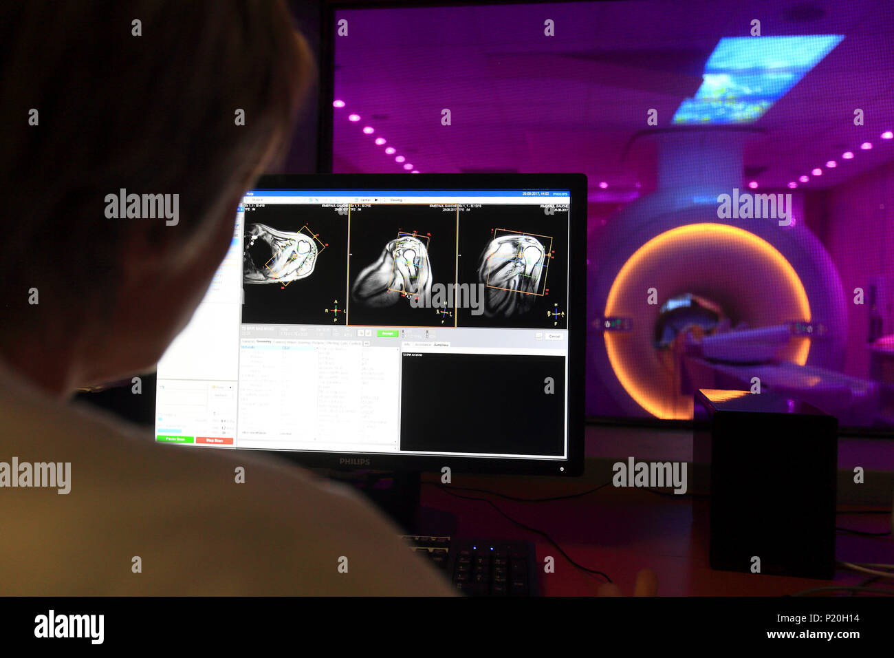 I medici esame di scansione sul computer con il paziente su scanner MRI in background Foto Stock