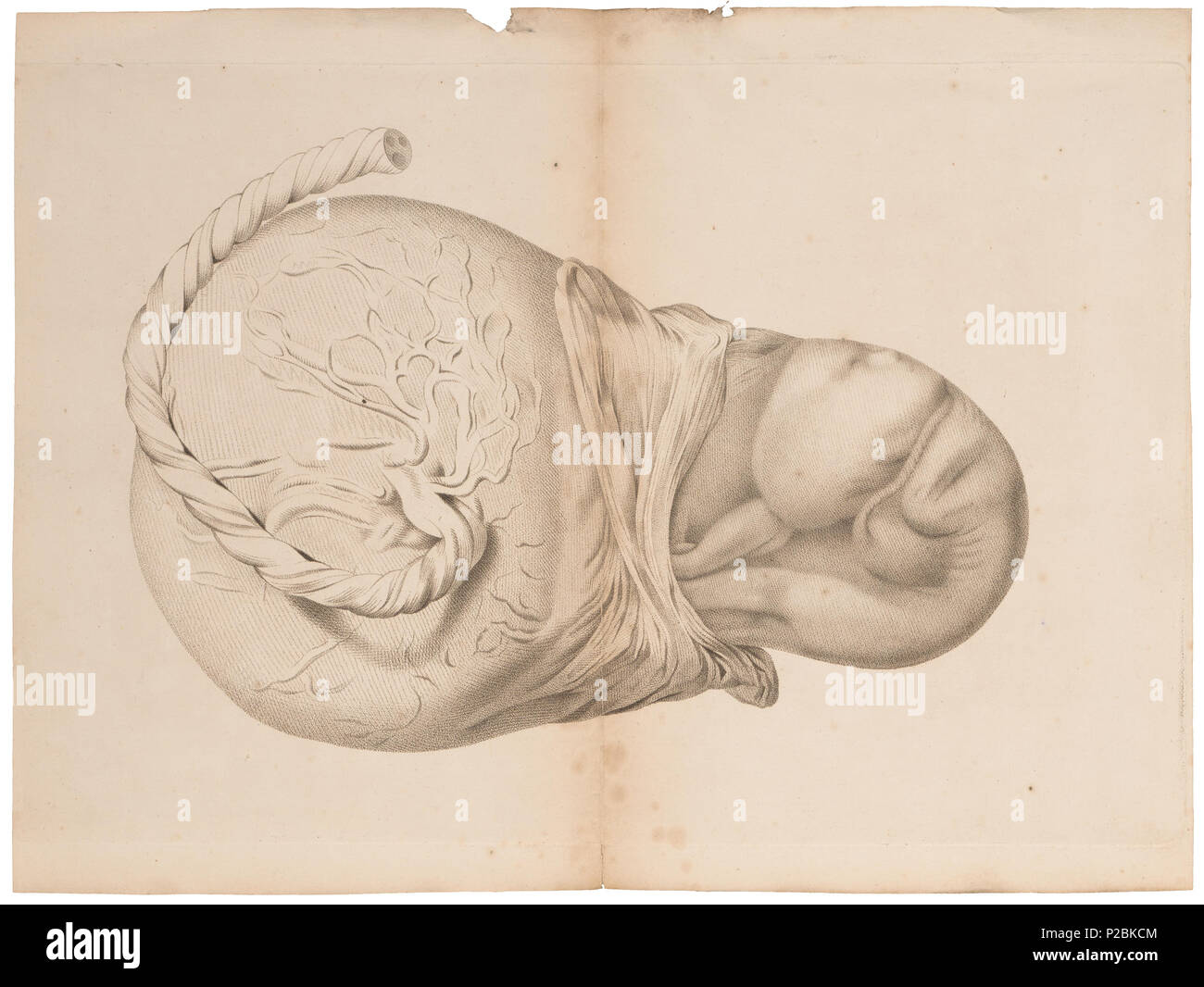 UBA01 IZ19600132-y, 23-09-09, 14:14, 8C, 7020x9179 (643+424), 100%%%%, BasisCurve Arte, 1/50 s, R49.6, G19.4, B12.4 151 Homo sapiens - embrione - 1700-1880 - Stampa - Iconographia Zoologica - Collezioni Speciali Università di Amsterdam - UBA01 IZ19600123 Foto Stock