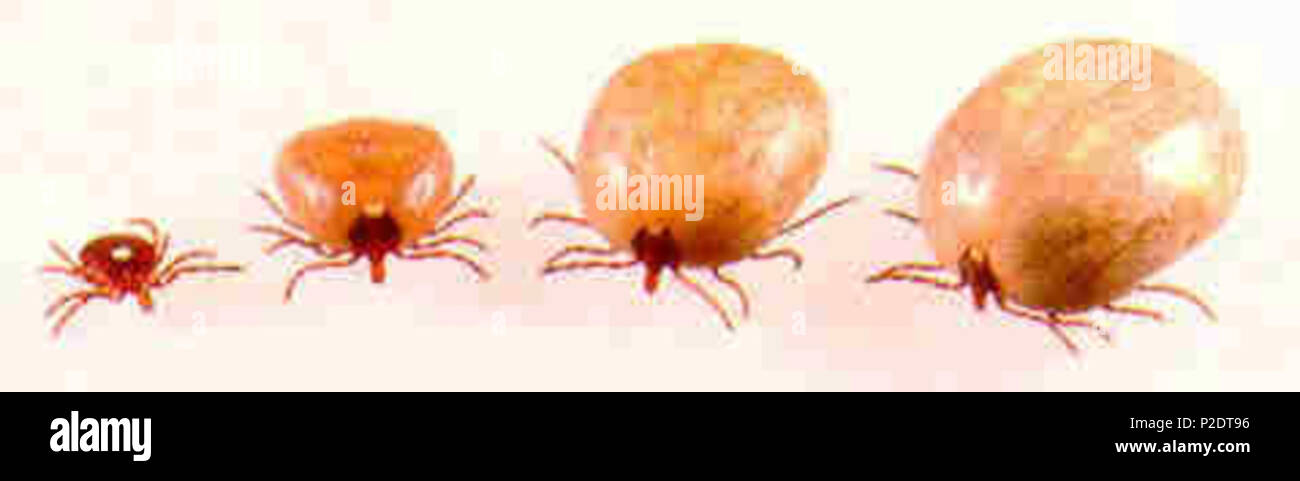 . Nederlands: Teken kunnen door het opzuigen van bloed tot vele malen hun oorspronkelijke grootte uitgroeien. Bron: Washington Dipartimento di Stato della Salute, http://www.doh.wa.gov. Origineel op: http://www.doh.wa.gov/ehp/ts/Zoo/WATickDiseases.htm. 'Le informazioni presentate dal governo su questo sito web è considerato pubblico informazioni e può essere distribuita o copiata. L'uso di opportune byline/crediti immagine è richiesto.' . Il 13 maggio 2004 (originale data di caricamento). Washington State Department of Health 62 Teek4 Foto Stock