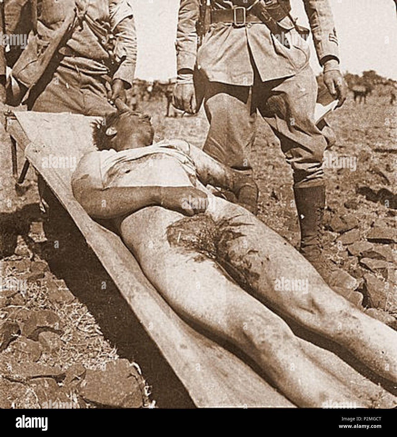 . Inglese: militari italiani indebolite Seconda Guerra Italo-Ethiopian . Il 13 febbraio 1936. Anonimo 42 militari italiani indebolite Seconda Guerra Italo-Ethiopian Foto Stock