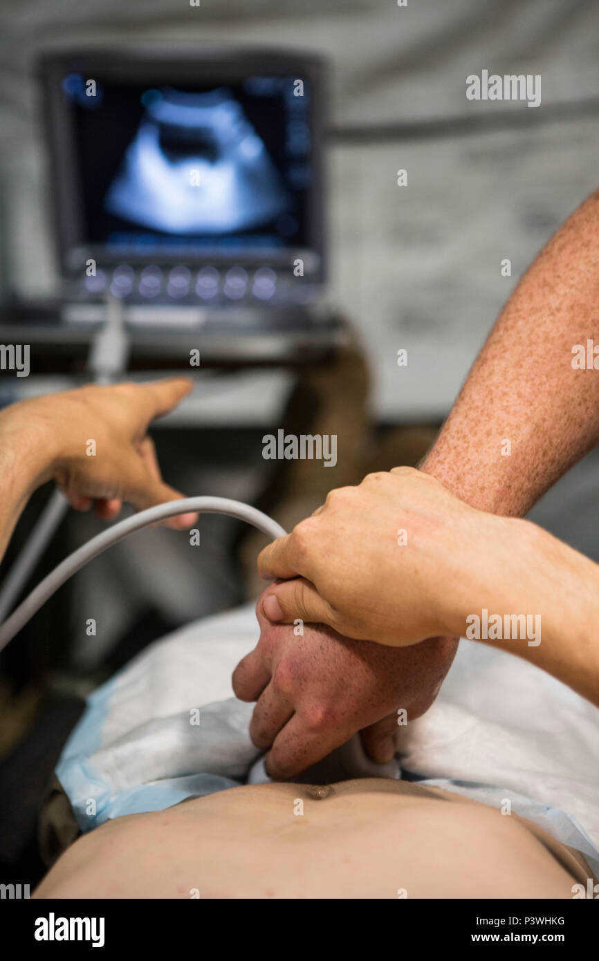 Stati Uniti Navy Lt. La Cmdr. Robert Oldt, medico di emergenza con scopi speciali Air-Ground Marine Task Force-Crisis Response-Africa dimostra il corretto posizionamento delle procedure per lo svolgimento di una valutazione focalizzata con Sonogram nel Trauma esame con U.S. Navy Corpsman, 21 luglio 2016. SPMAGTF-CR-AF personale medico condotto esami veloce usando Forward Resuscitative chirurgia trauma System-Shock plotone per migliorare la prontezza di missione in caso di crisi future. FAST è un rapido posto letto ecografia eseguita da chirurghi, medici di emergenza e alcuni paramedici come un test di screening per bl Foto Stock