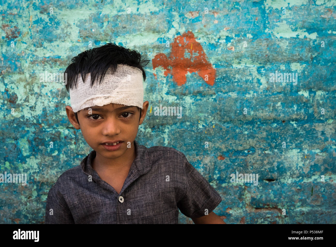 Ritratto di un ragazzo bendato nel retro dei vicoli di Calcutta, in India. 13 Novembre 2017 Foto Stock