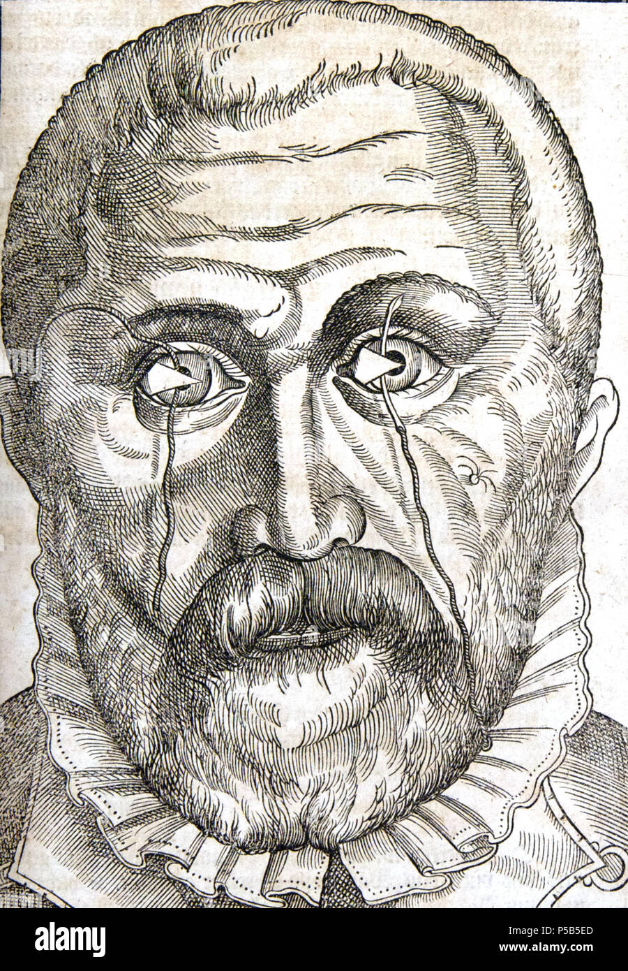 N/A. Ophthalmodouleia, p. 144r . 1583. Georg Bartisch (1535-1607) Descrizione medico tedesco Data di nascita e morte 1535 1607 Luogo di nascita e morte Königsbrück Dresden competente controllo : Q108791 VIAF: 2756676 ISNI: 0000 0000 6659 9176 LCCN: N84801781 GND: 124149286 SUDOC: 074649248 WorldCat 173 Bartisch-144r Foto Stock