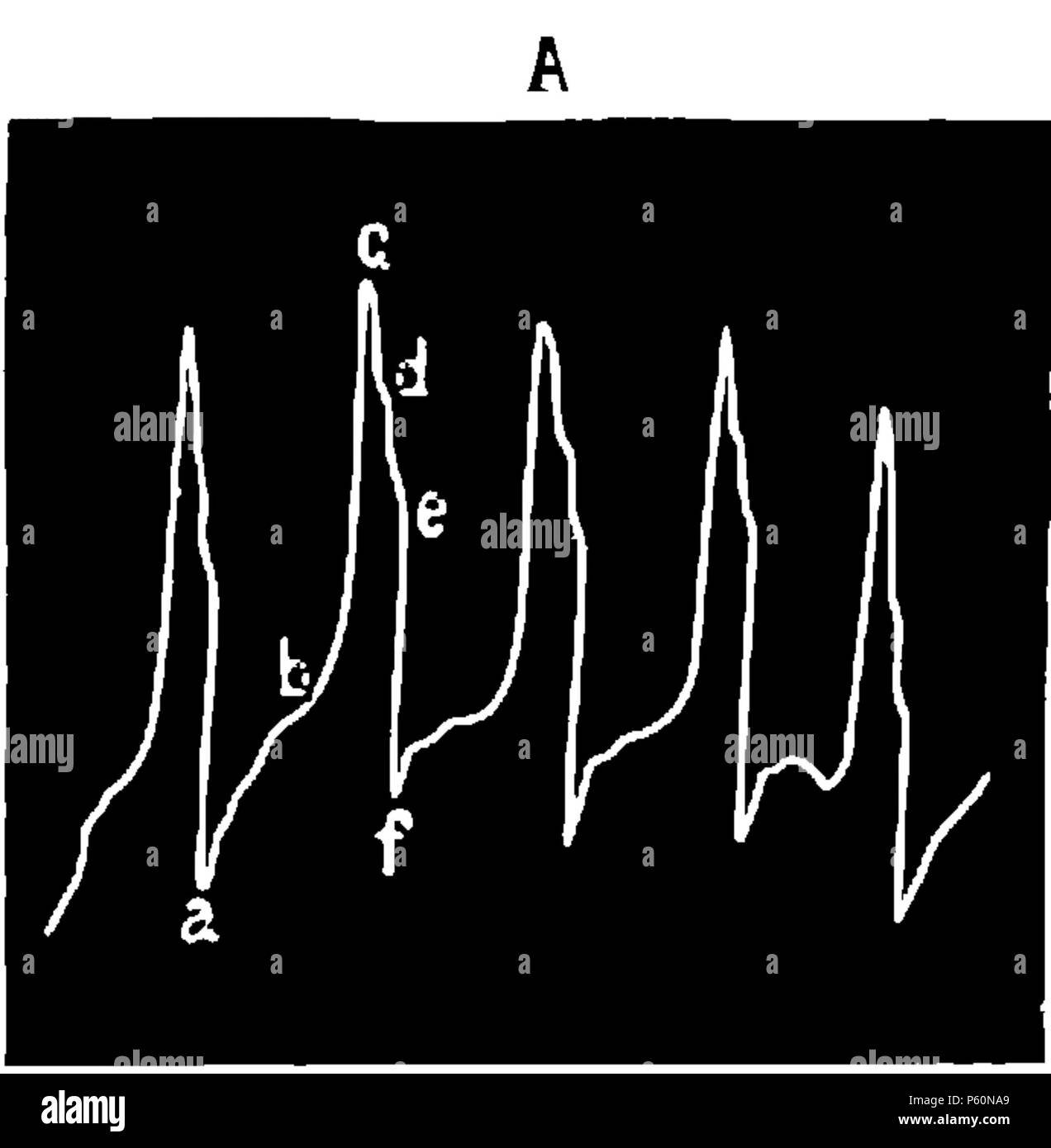 555 FI-d065-fig. 13 - Cardiogramme normale Foto Stock