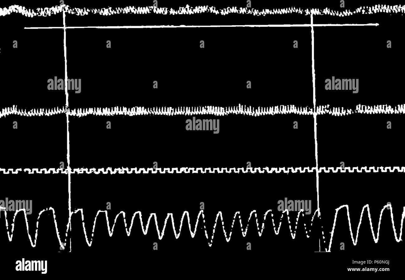 555 FI-d167-fig. 63 - Modifica rythme respiratoire - travail intellectuel Foto Stock