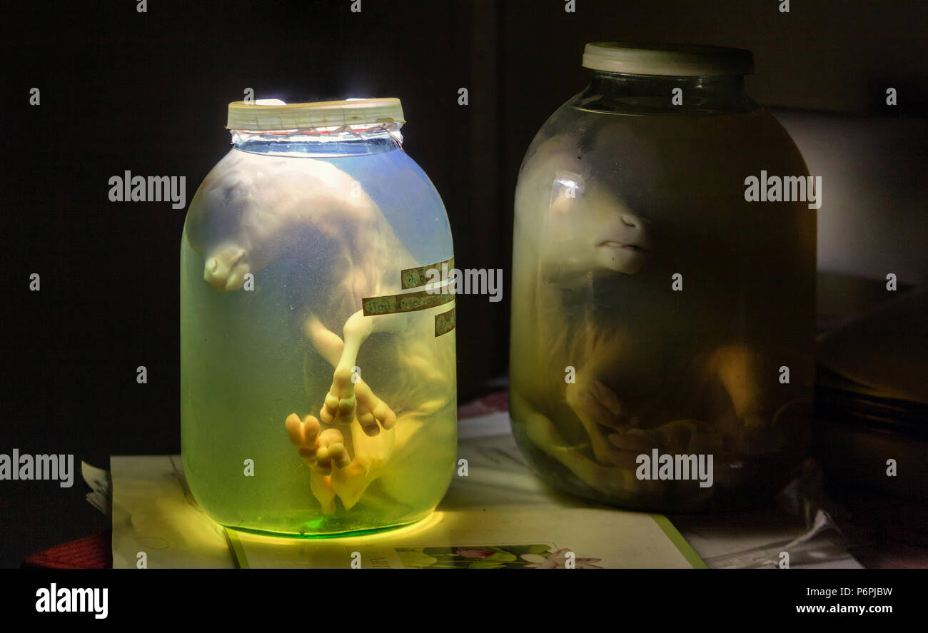 Embrione di vitello in un barattolo di vetro con formalina. Preparazione veterinaria Foto Stock