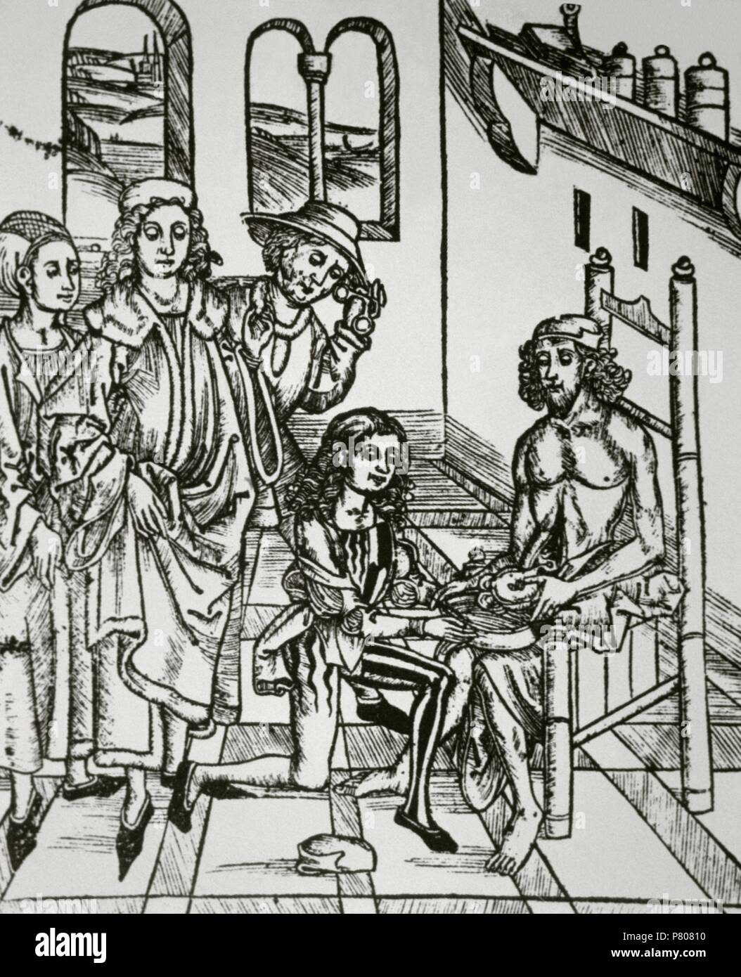 La storia della medicina. La saturazione dell'intestino. Xilografia in Dies ist das Buch Der Chirurgia (questo è il libro della chirurgia), xv secolo. Foto Stock