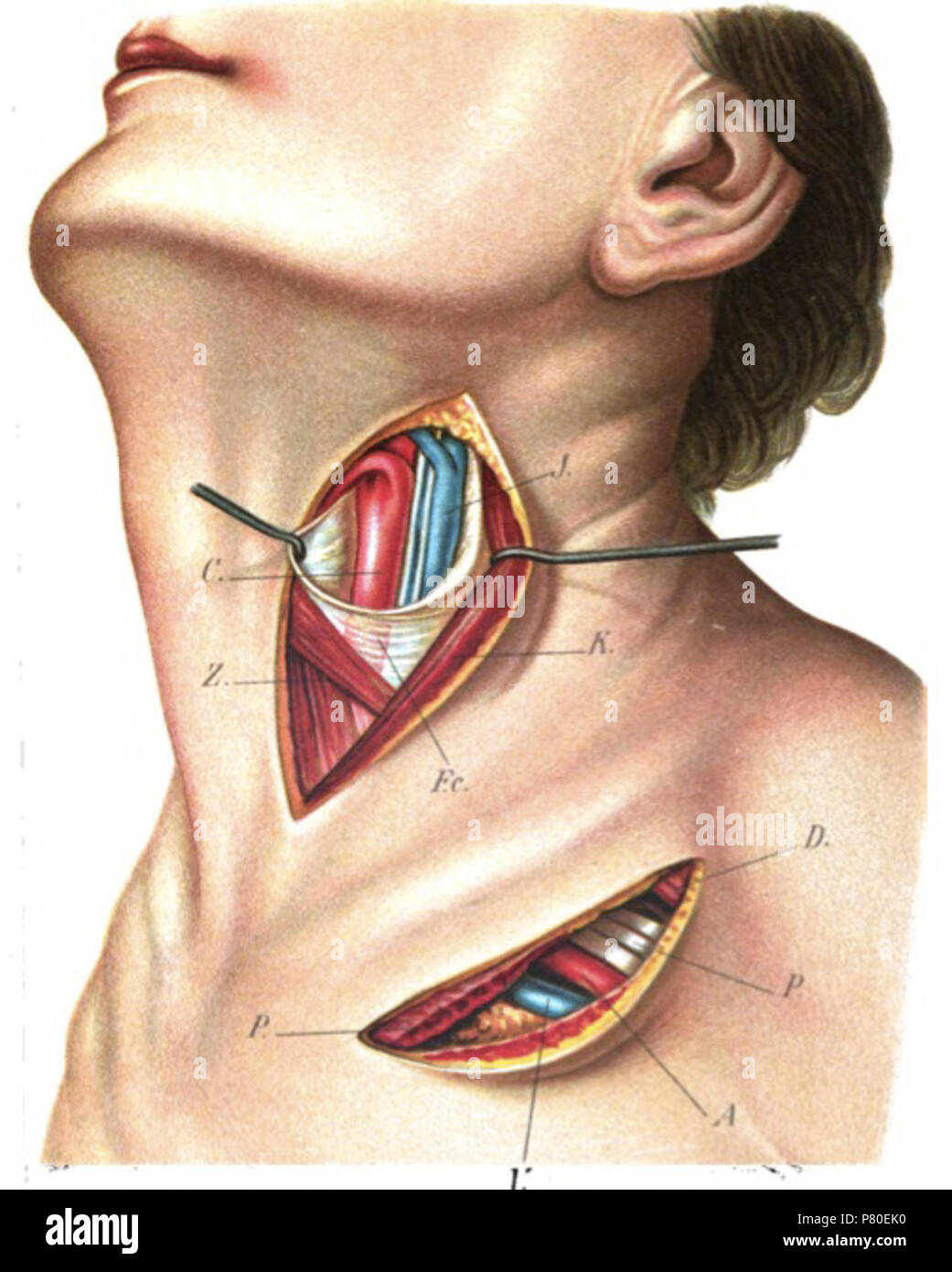 Inglese: arteria carotide esterna che mostra la posizione di ligazione del superior arteria della tiroide. 1902 316 la piastra 16 Zuckerkandl Foto Stock