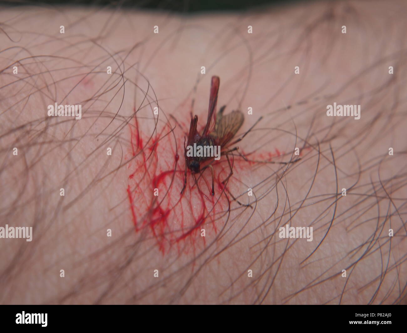 Una zanzara schiacciata in una pozza di sangue sulla pelle umana. Close up  Foto stock - Alamy