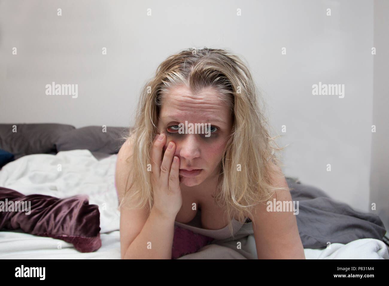 La donna sembra confusa e malati nel letto, tirando sulla faccia con ill guardando gli occhi Foto Stock