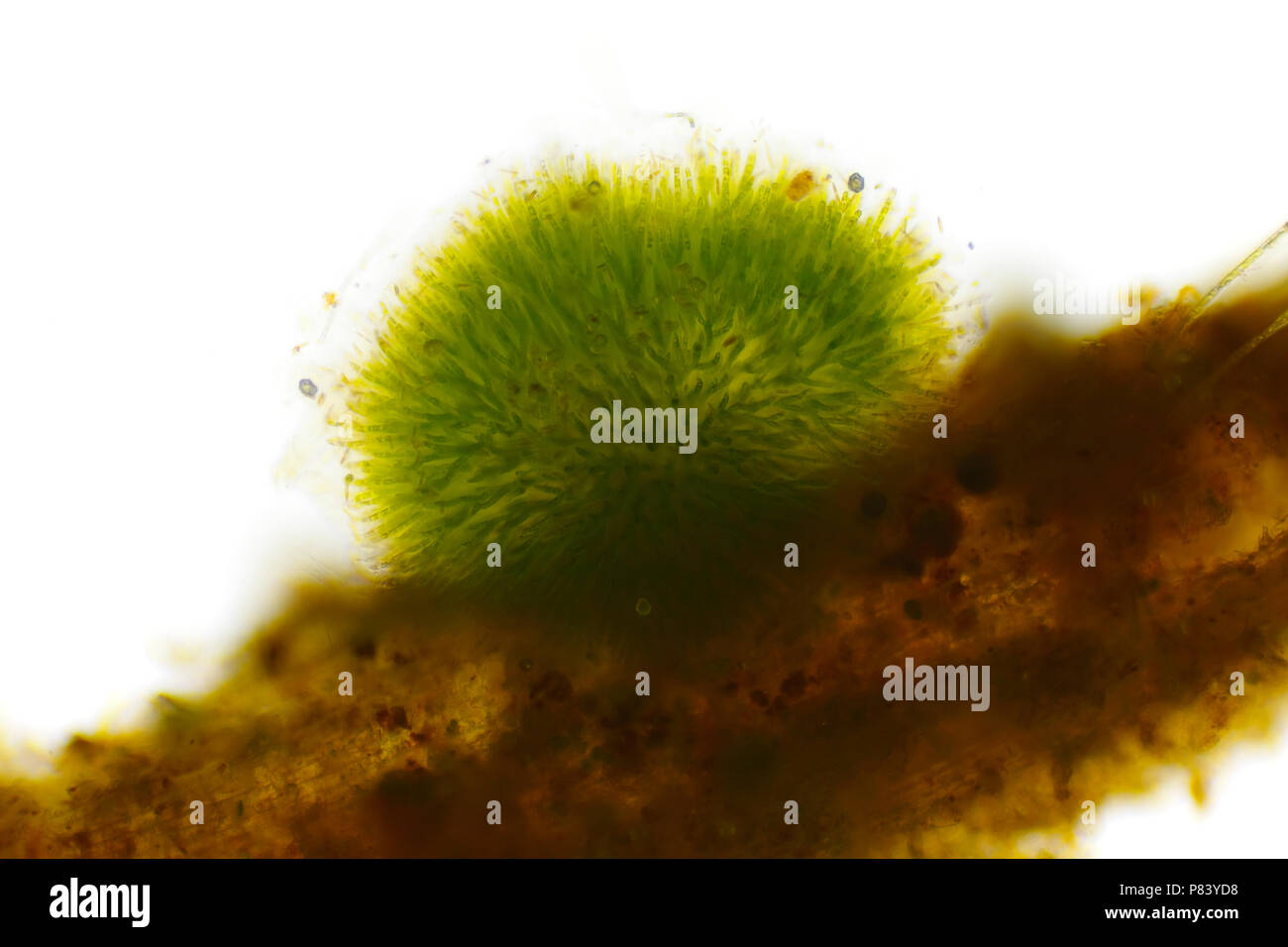 Colonia sferica di cianobatteri (Gleotrichia, alghe blu-verdi). Vista laterale, illuminazione a campo chiaro. Foto Stock