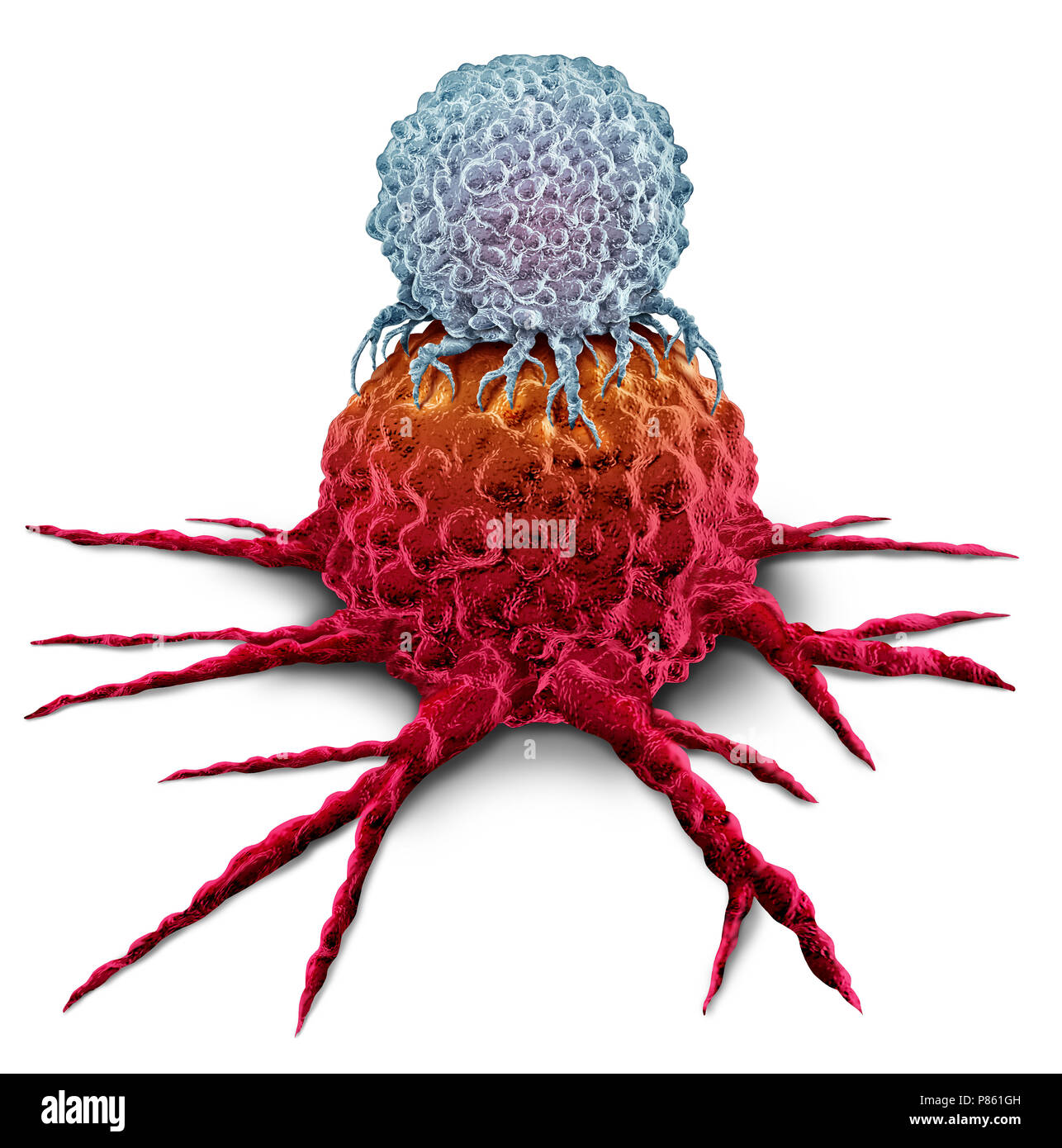 Cellula T che attacca un cancro tumore come immunoterapia sistema immunitario concetto di terapia come biomedici o biomedicina trattamento oncologico. Foto Stock