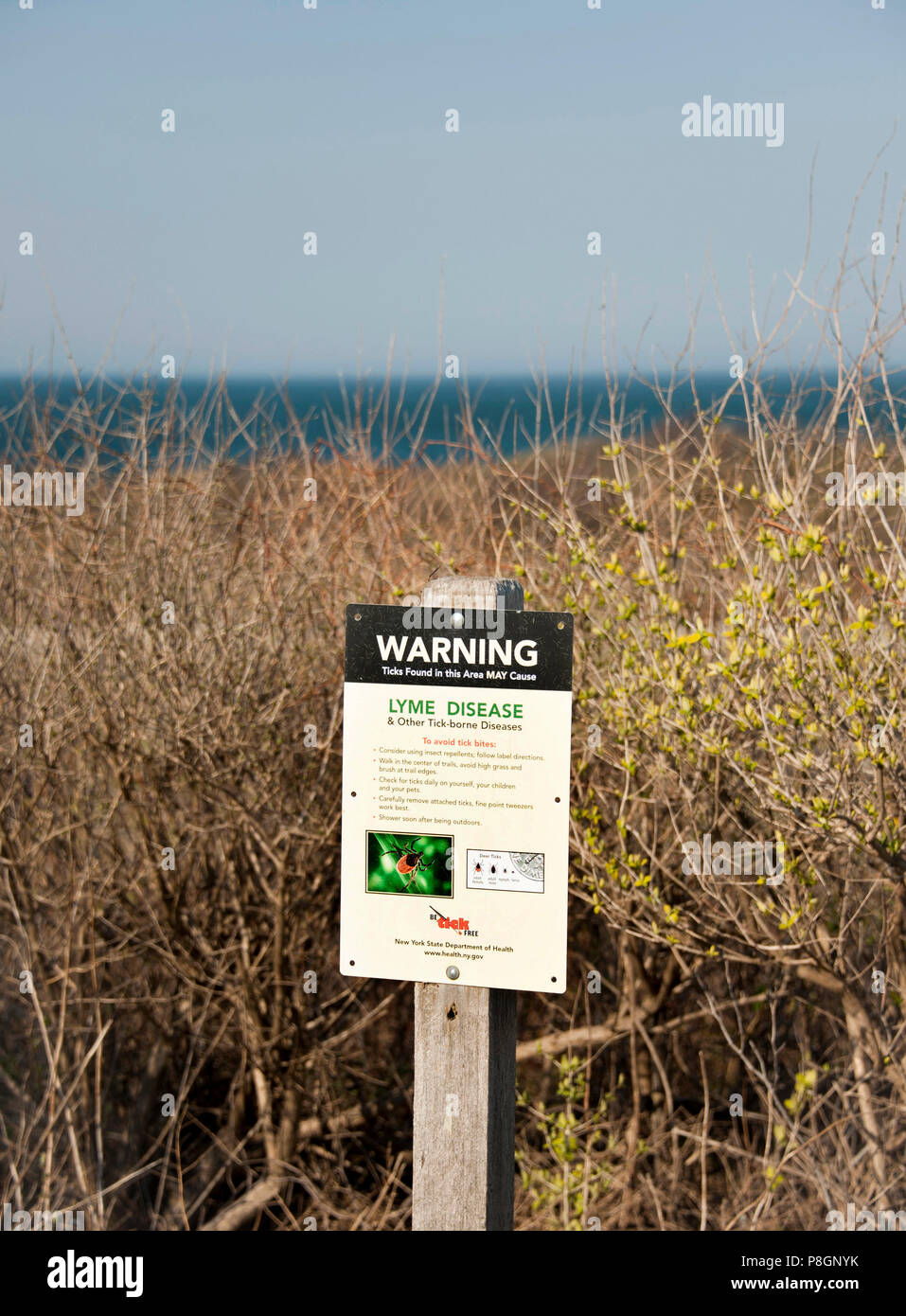Avvertenza di una possibile Malattia di Lyme da zecche Foto Stock
