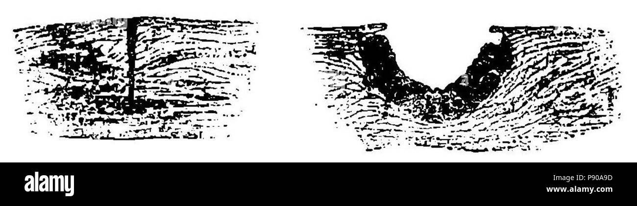 . 314 Grierson 57 Cortes de piel con heridas Foto Stock