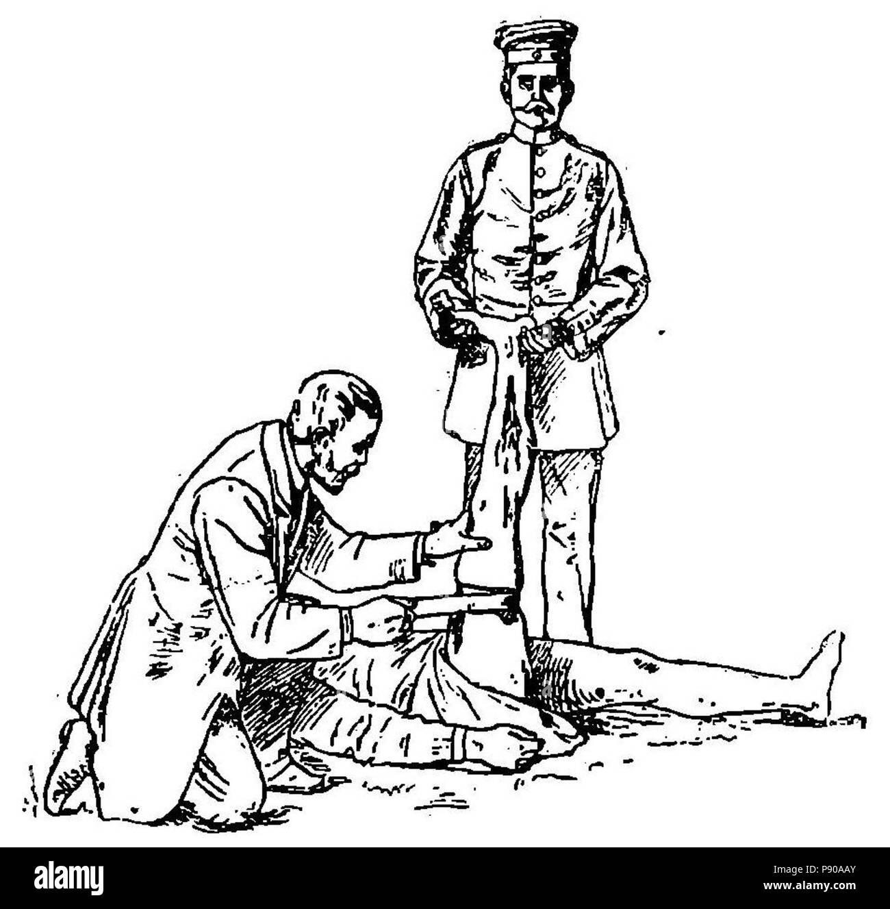 314 Grierson 78 aplicación de venda en hemorragia Foto Stock