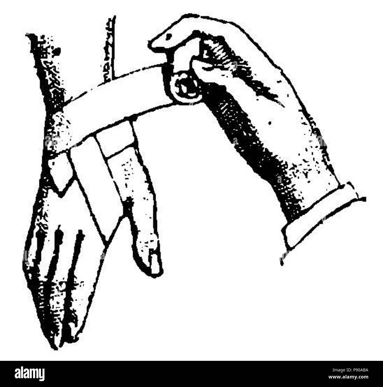 314 Grierson 87 Vendaje de muñeca Foto Stock