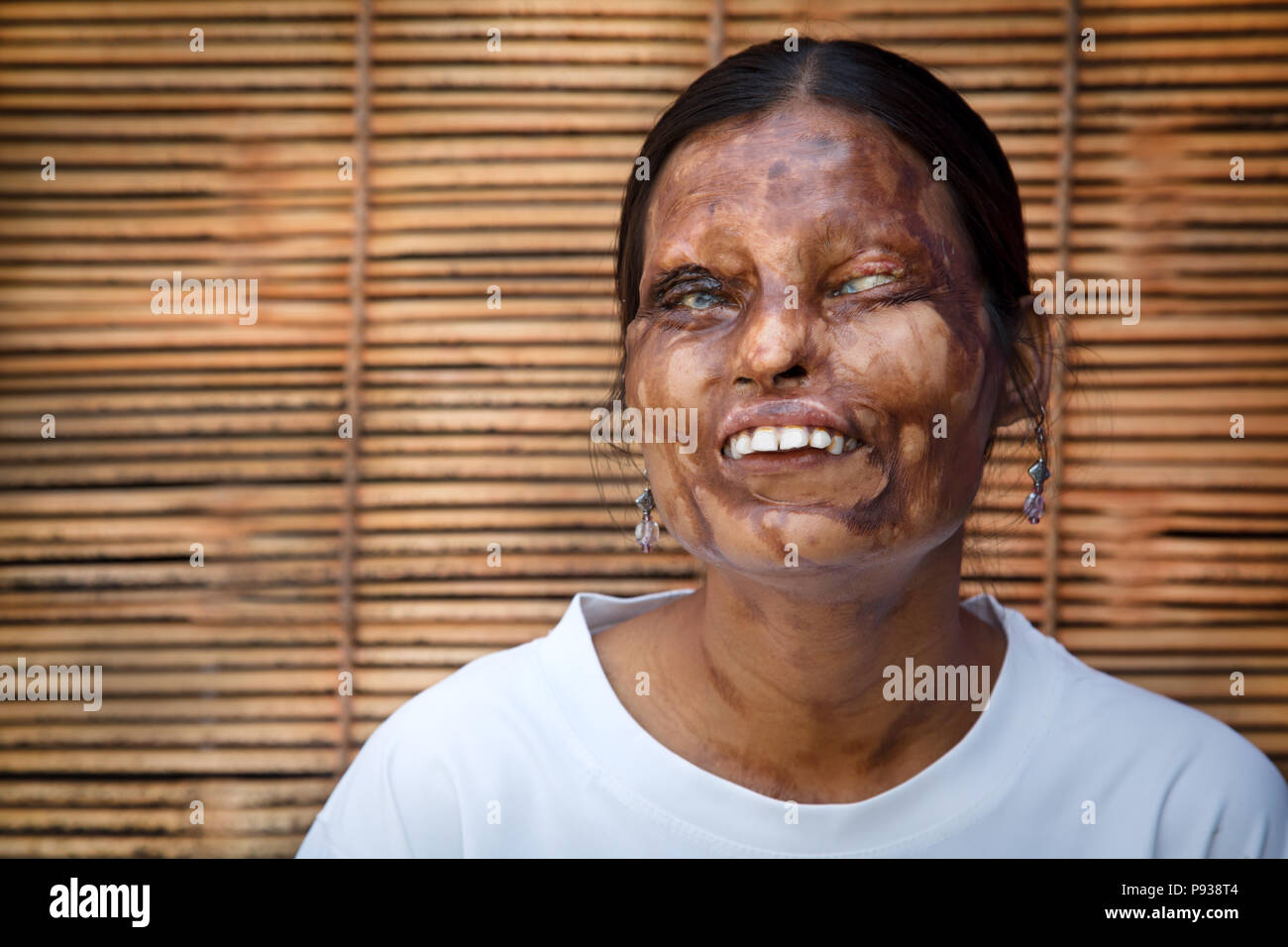 Vita quotidiana a Sheroes ritrovo (caffetteria ristorante) in Agra, detenute da ragazze vittime di attacchi di acido (da arrestare gli attacchi di acido campagna, India) Foto Stock