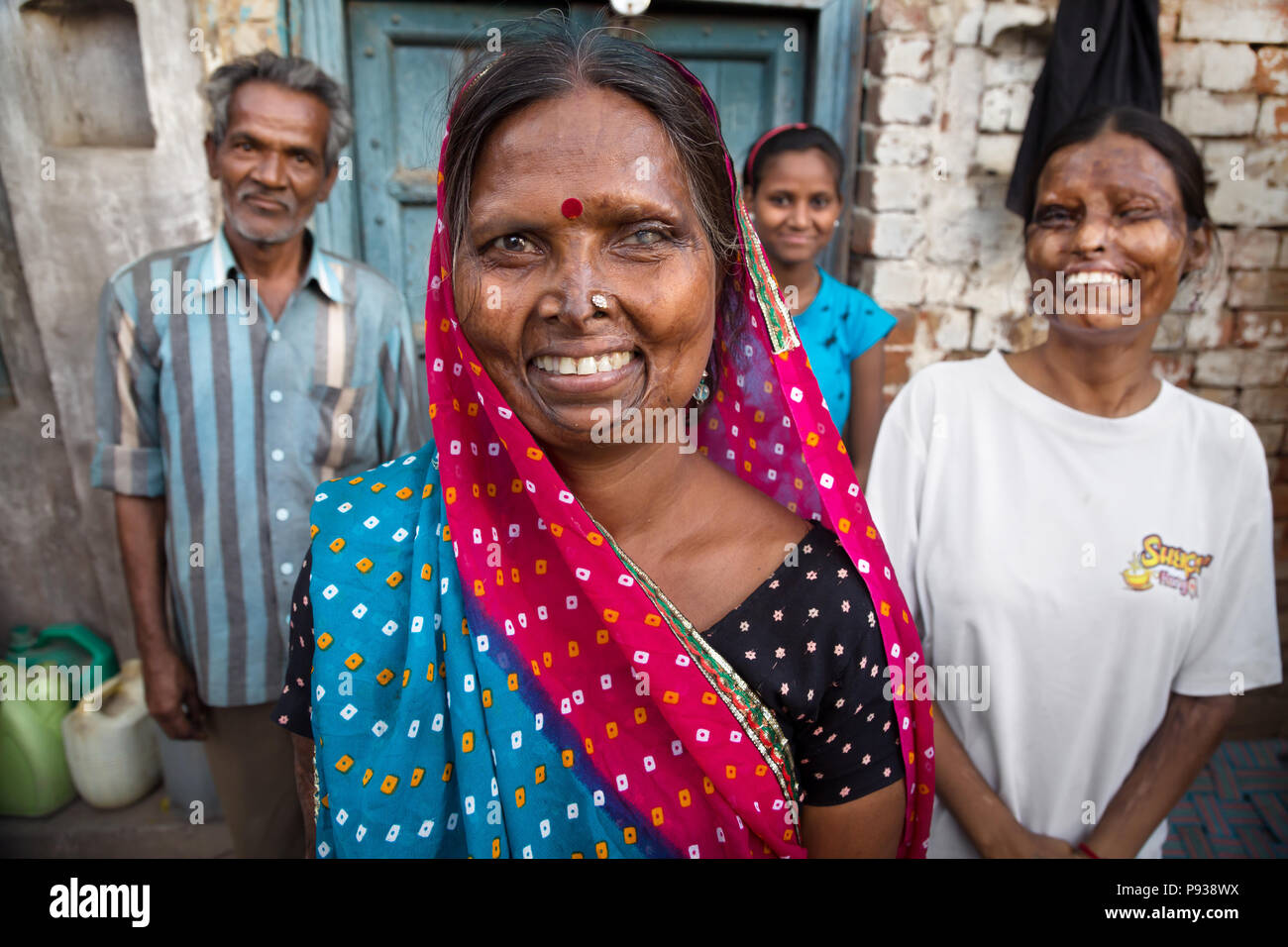 Gheeta con la famiglia, vittima di attacco acido in Agra (da arrestare gli attacchi di acido campagna, India) Foto Stock