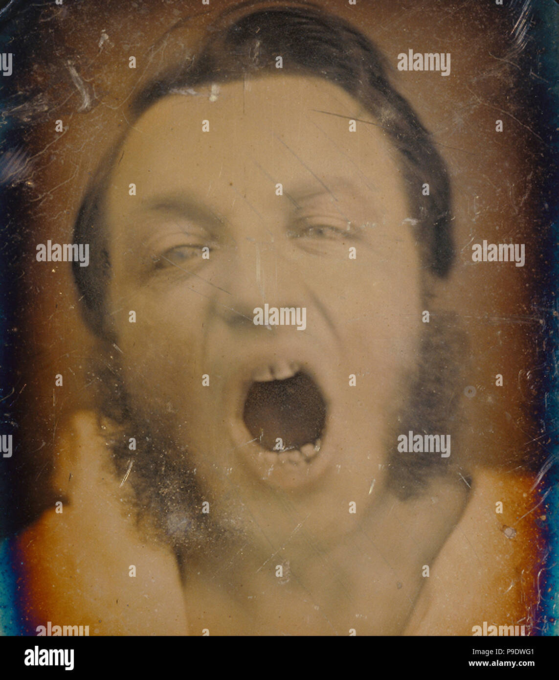 L'uomo con la bocca aperta; Unknown maker, francese; circa 1852; Daguerreotype, colorate a mano; 1/4 piastra, Immagine: 9,4 x 7,3 cm (3 11/16 x 2 7/8 in.), la piastra (1/4 piastra): 10,6 x 7,9 cm (4 3/16 x 3 1/8 in.), oggetto: 15 x 12,7 cm (5 7/8 x 5 in.); 84.XT.402.4 Foto Stock