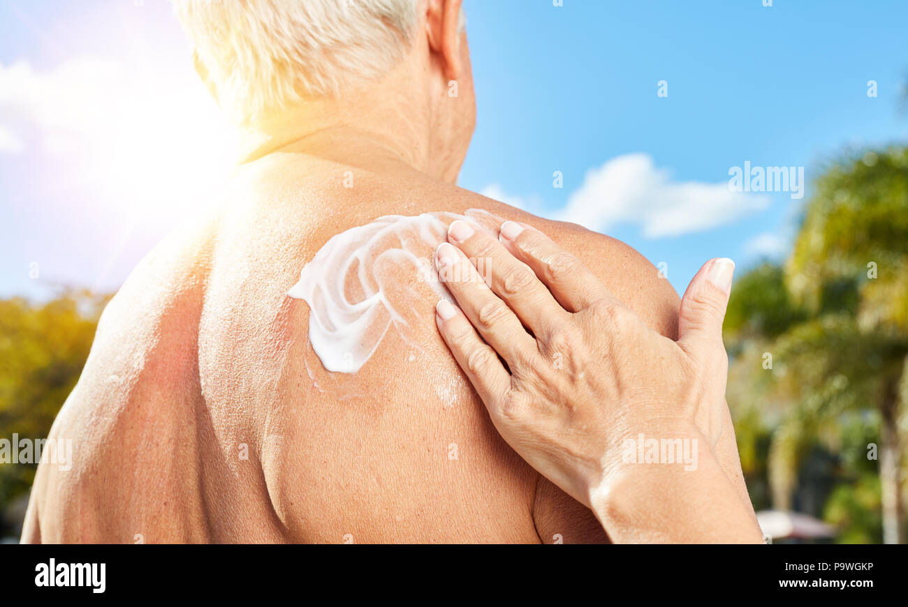 Senior uomo con sunscreen sulla sua schiena è crema con una mano Foto Stock