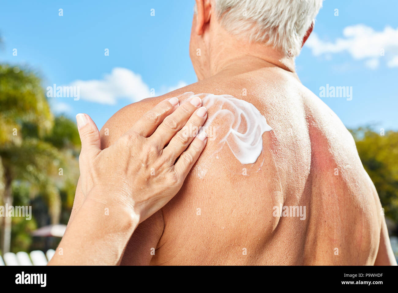 Donna sfrega sunscreen su un uomo con la schiena come protezione per la pelle in estate Foto Stock