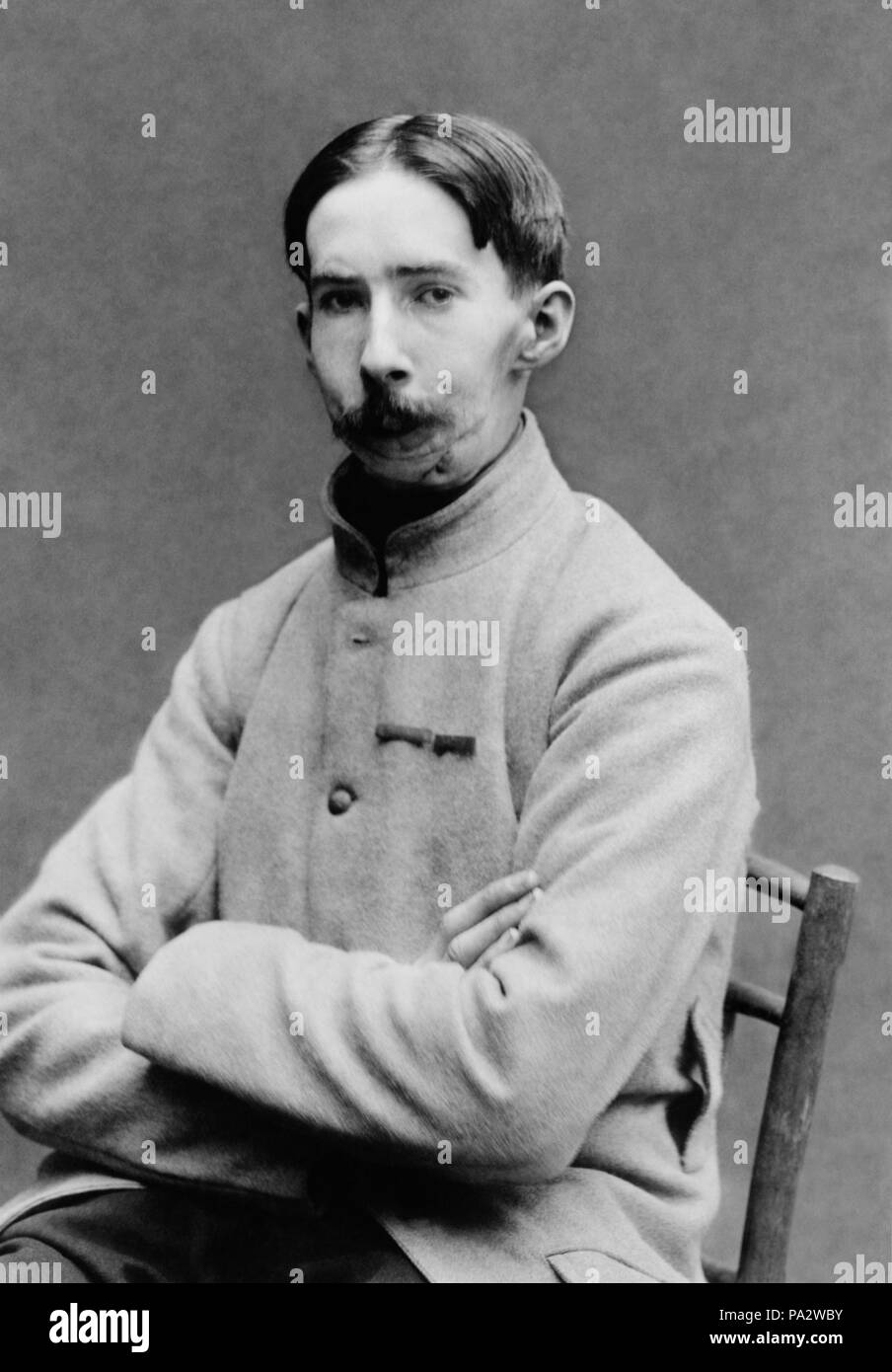 676 mutilé francese senza maschera1 Foto Stock