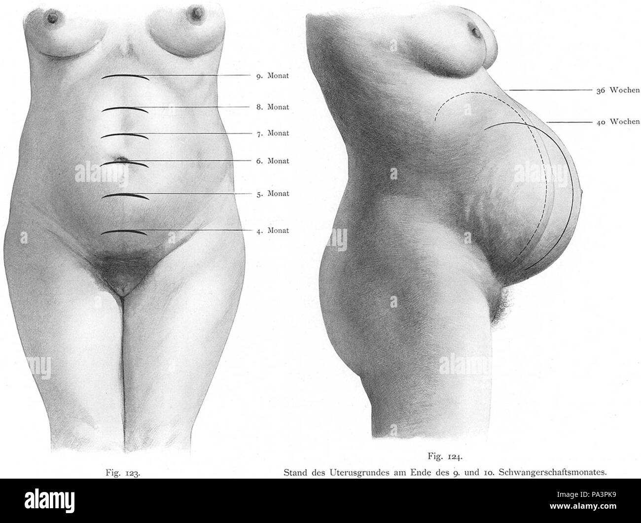 257 Bumm 123 lg Foto Stock