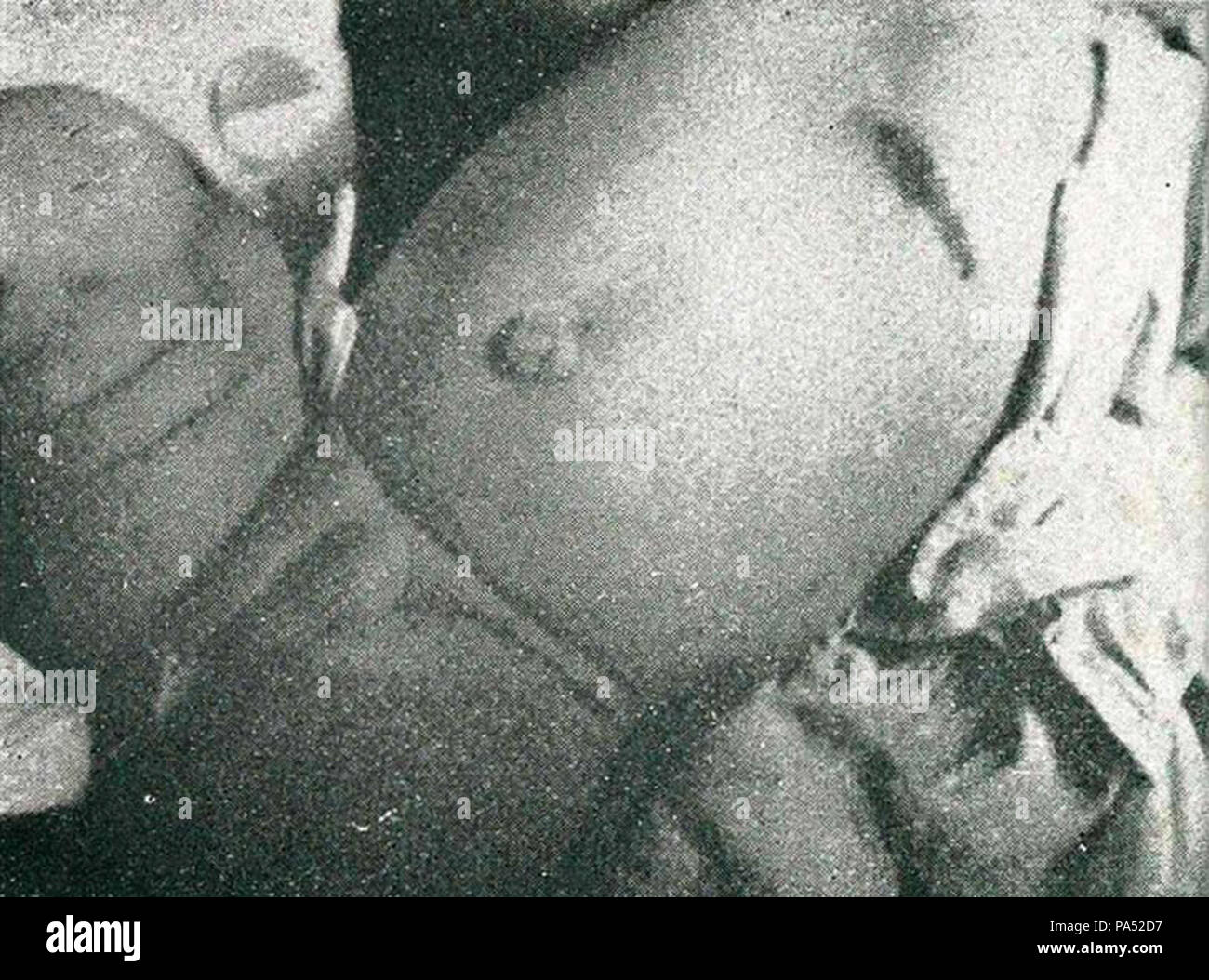 28 Baby shot nel torace 1, impressioni della lotta ... in Indonesia, p28 Foto Stock